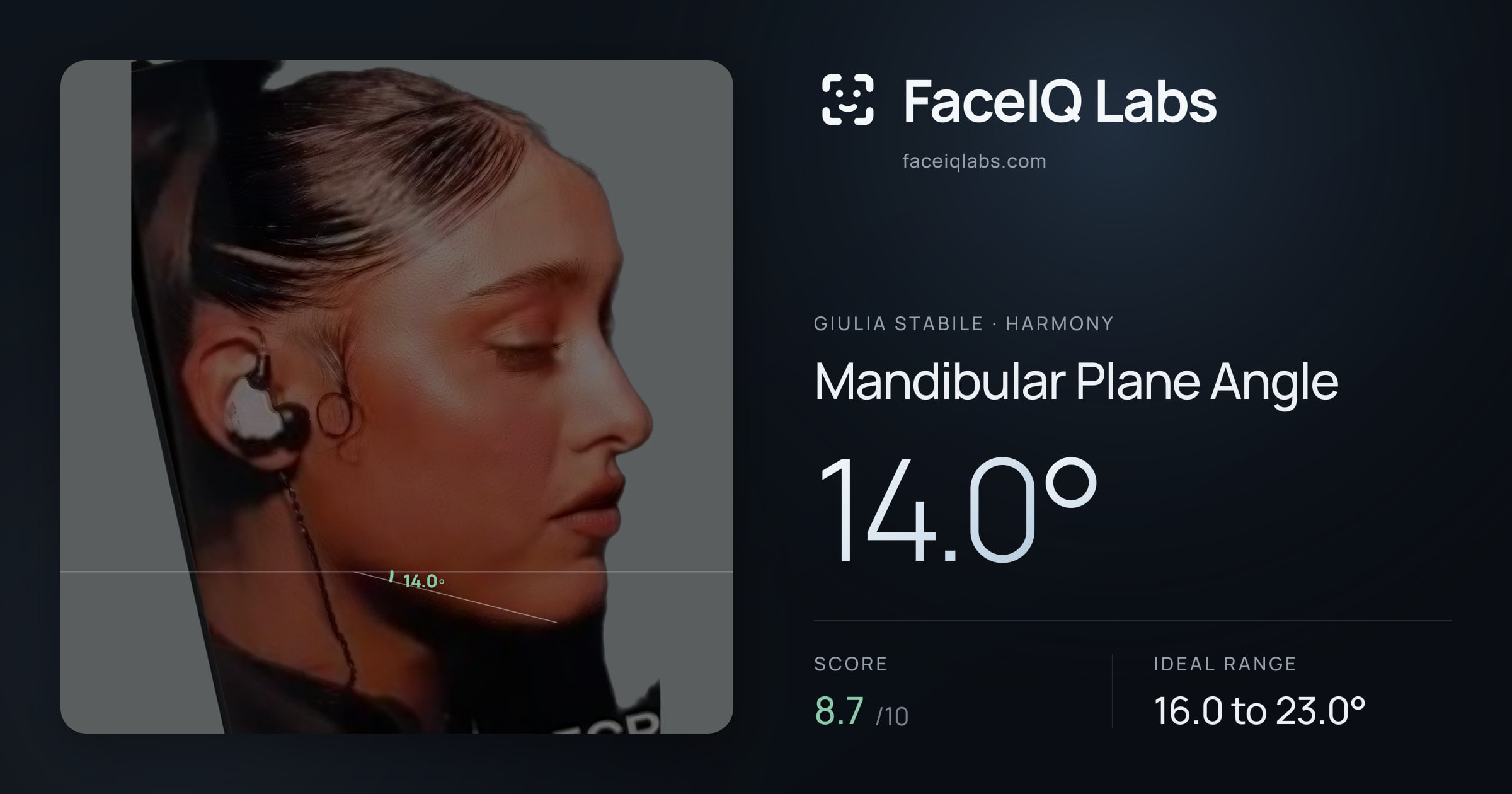 Giulia Stabile Mandibular Plane Angle: 14.0°, drawn on the photo