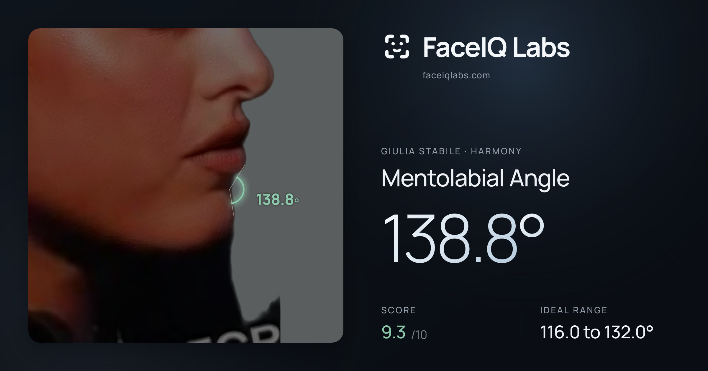 Giulia Stabile Mentolabial Angle: 138.8°, drawn on the photo