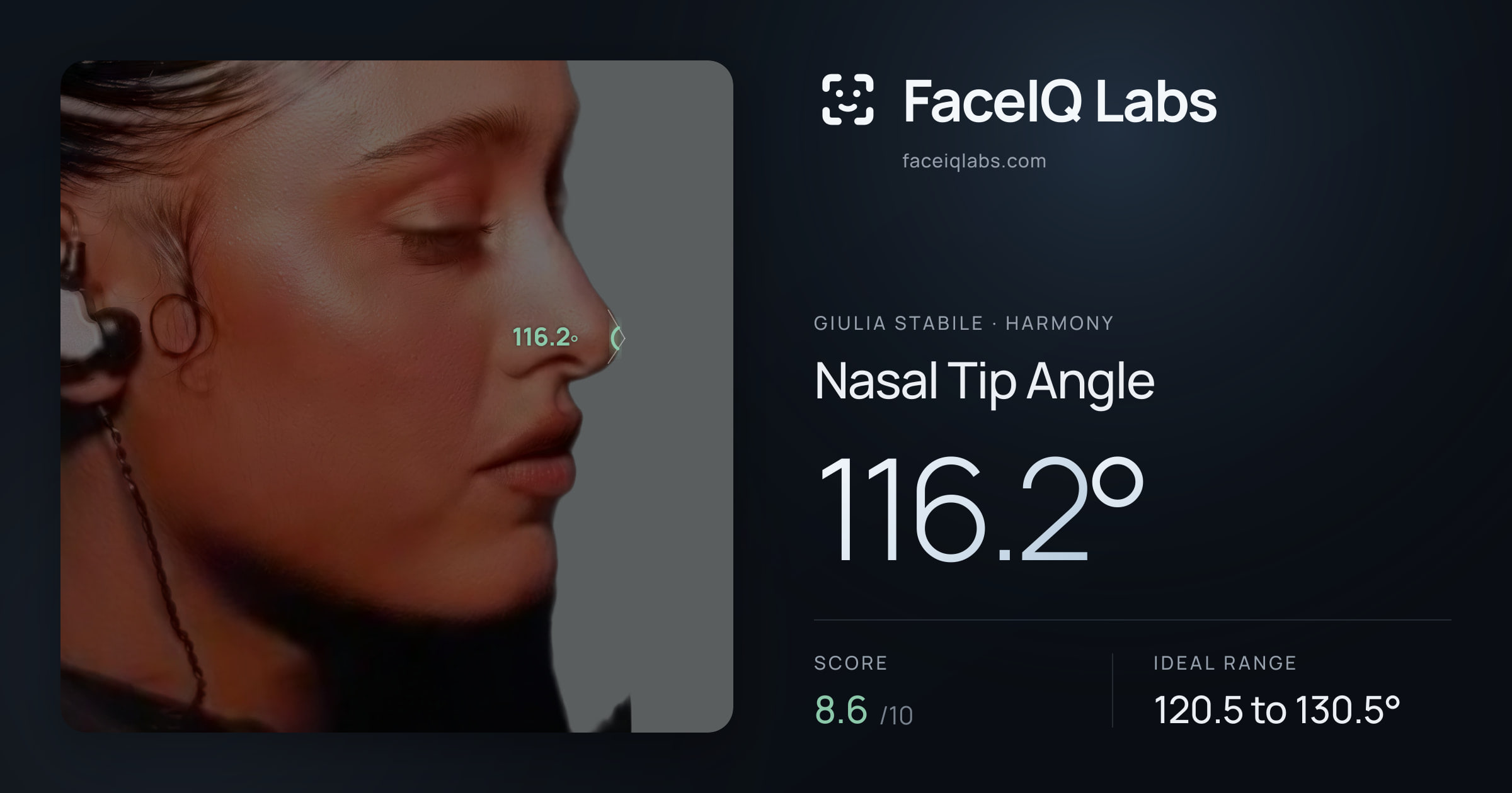 Giulia Stabile Nasal Tip Angle: 116.2°, drawn on the photo