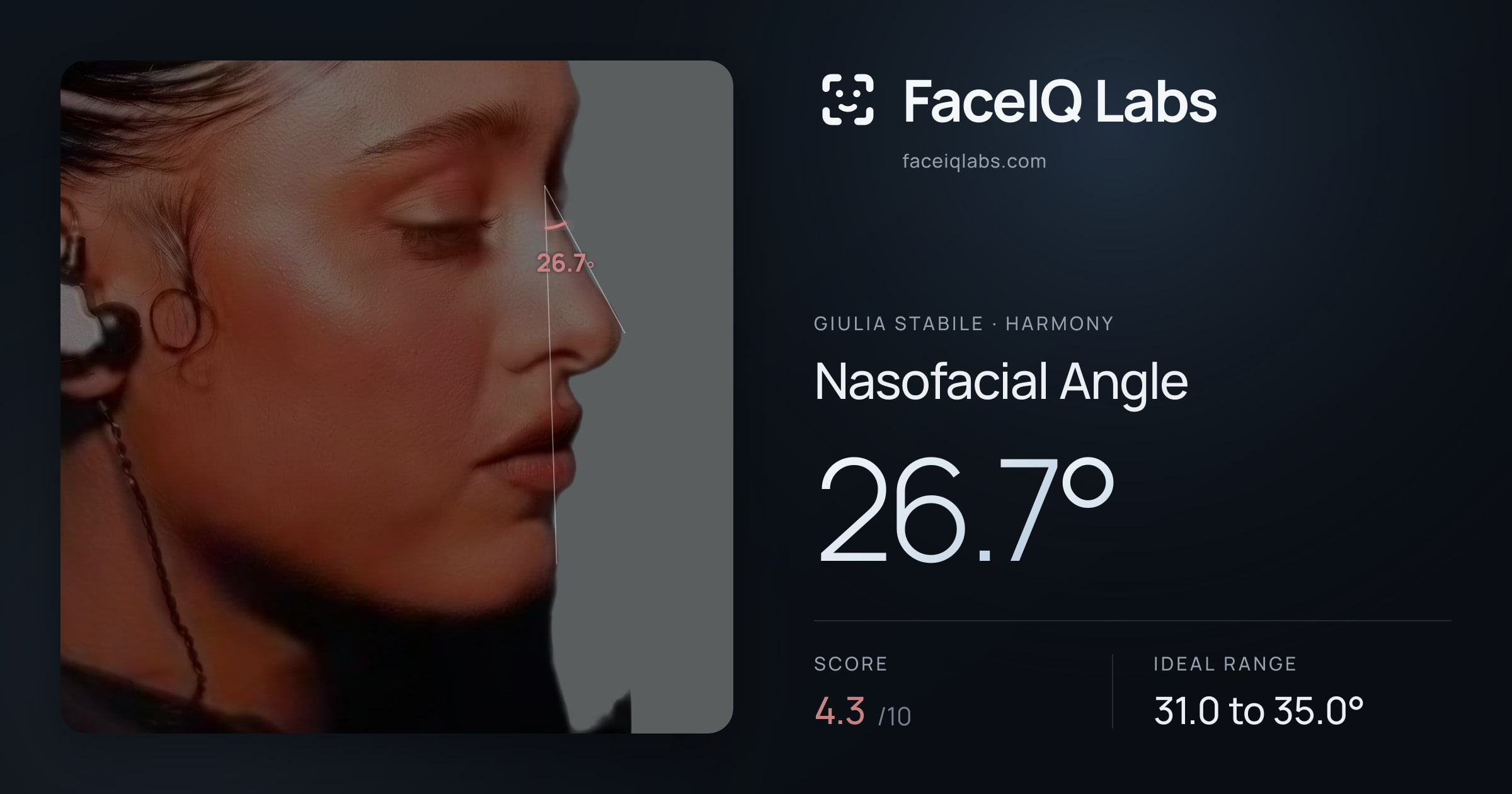 Giulia Stabile Nasofacial Angle: 26.7°, drawn on the photo