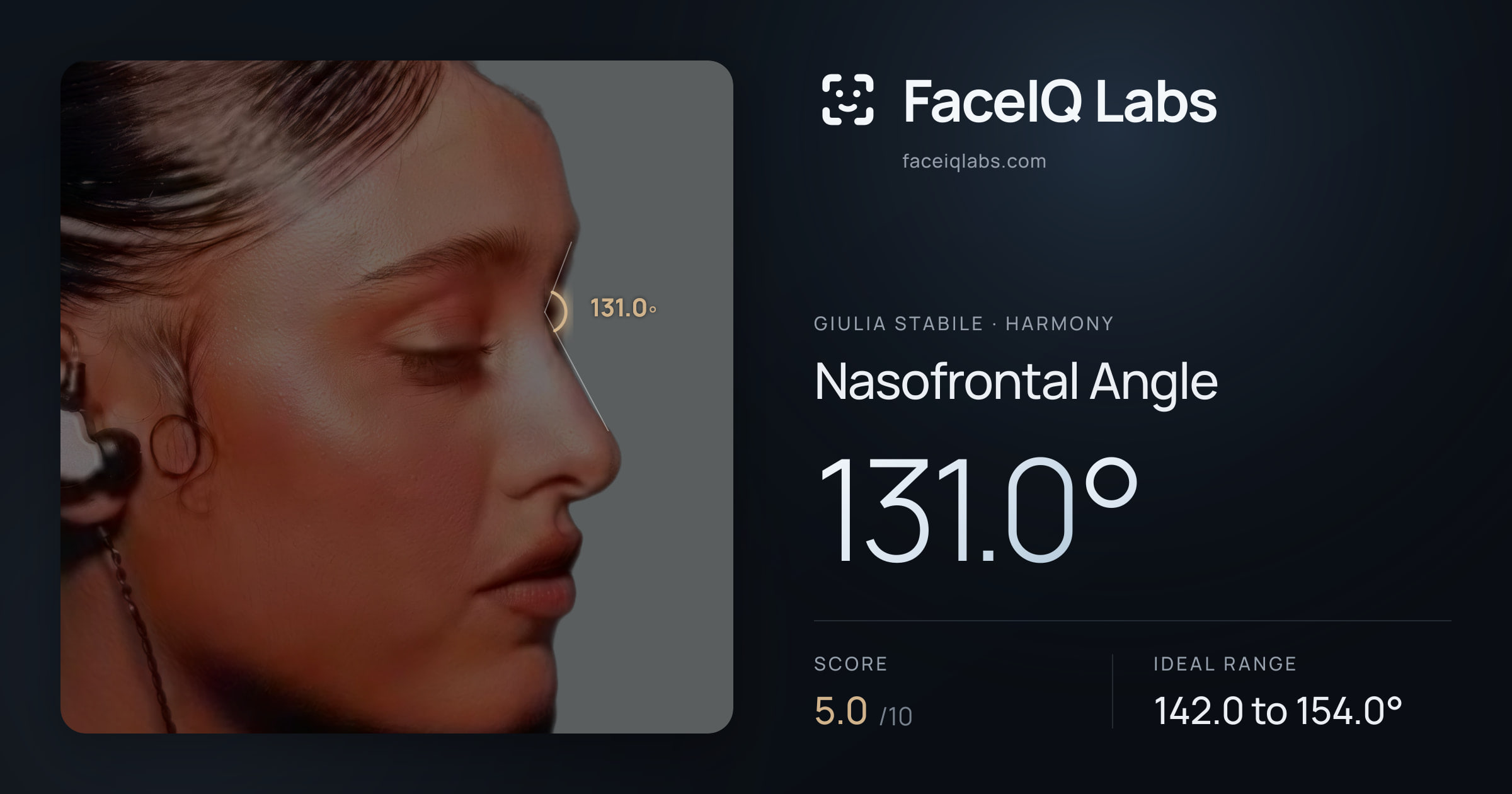Giulia Stabile Nasofrontal Angle: 131.0°, drawn on the photo