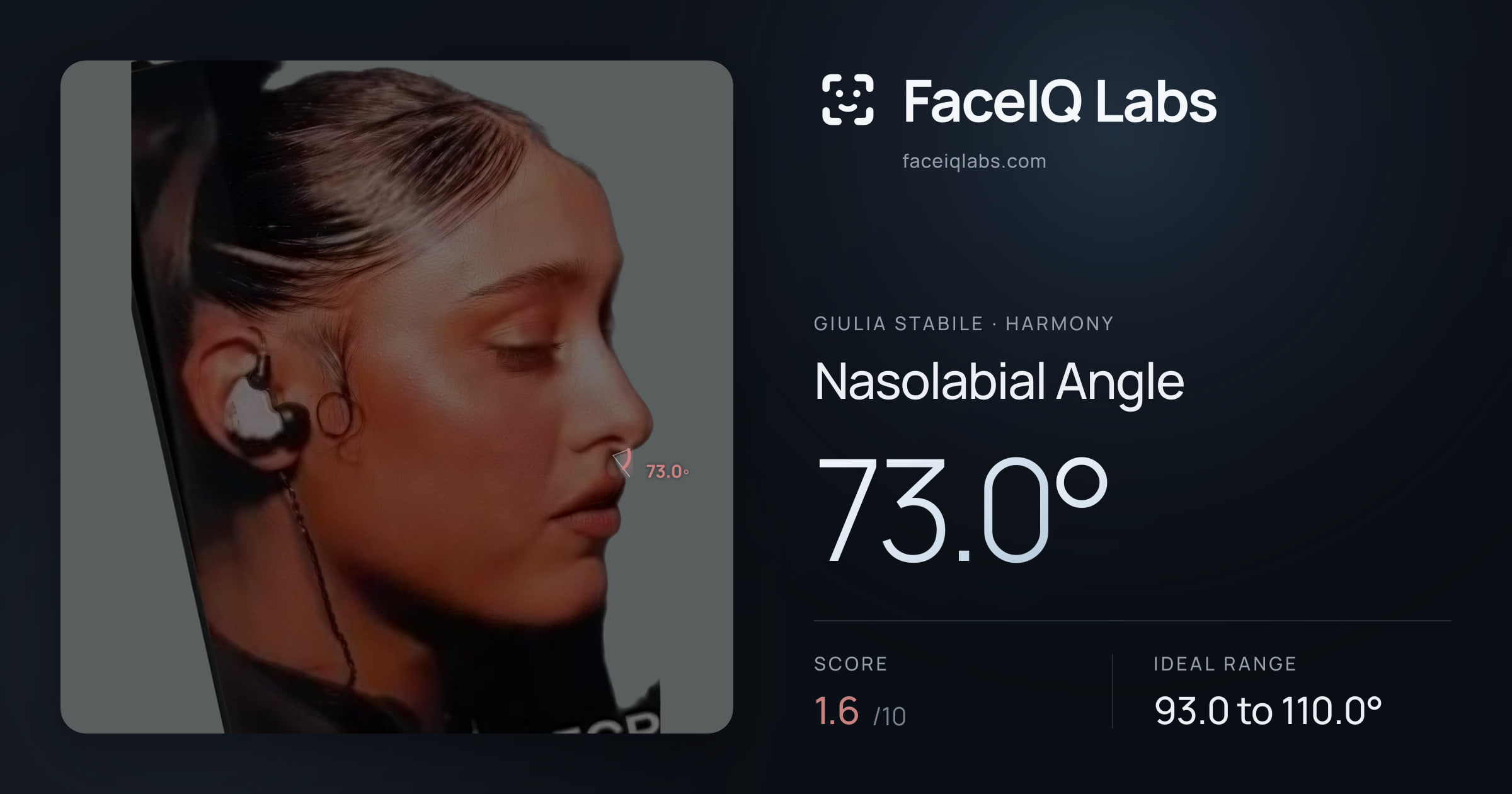 Giulia Stabile Nasolabial Angle: 73.0°, drawn on the photo