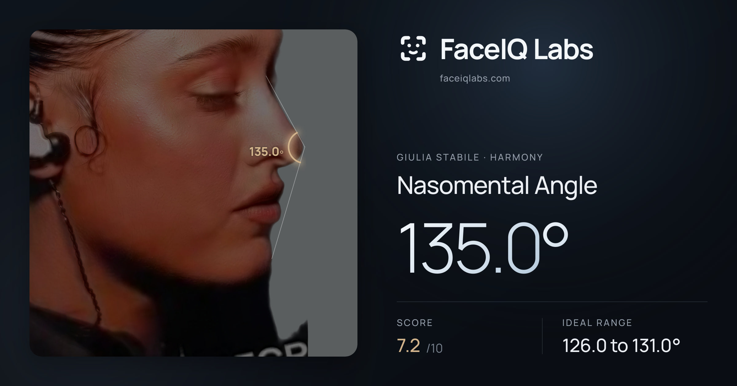 Giulia Stabile Nasomental Angle: 135.0°, drawn on the photo