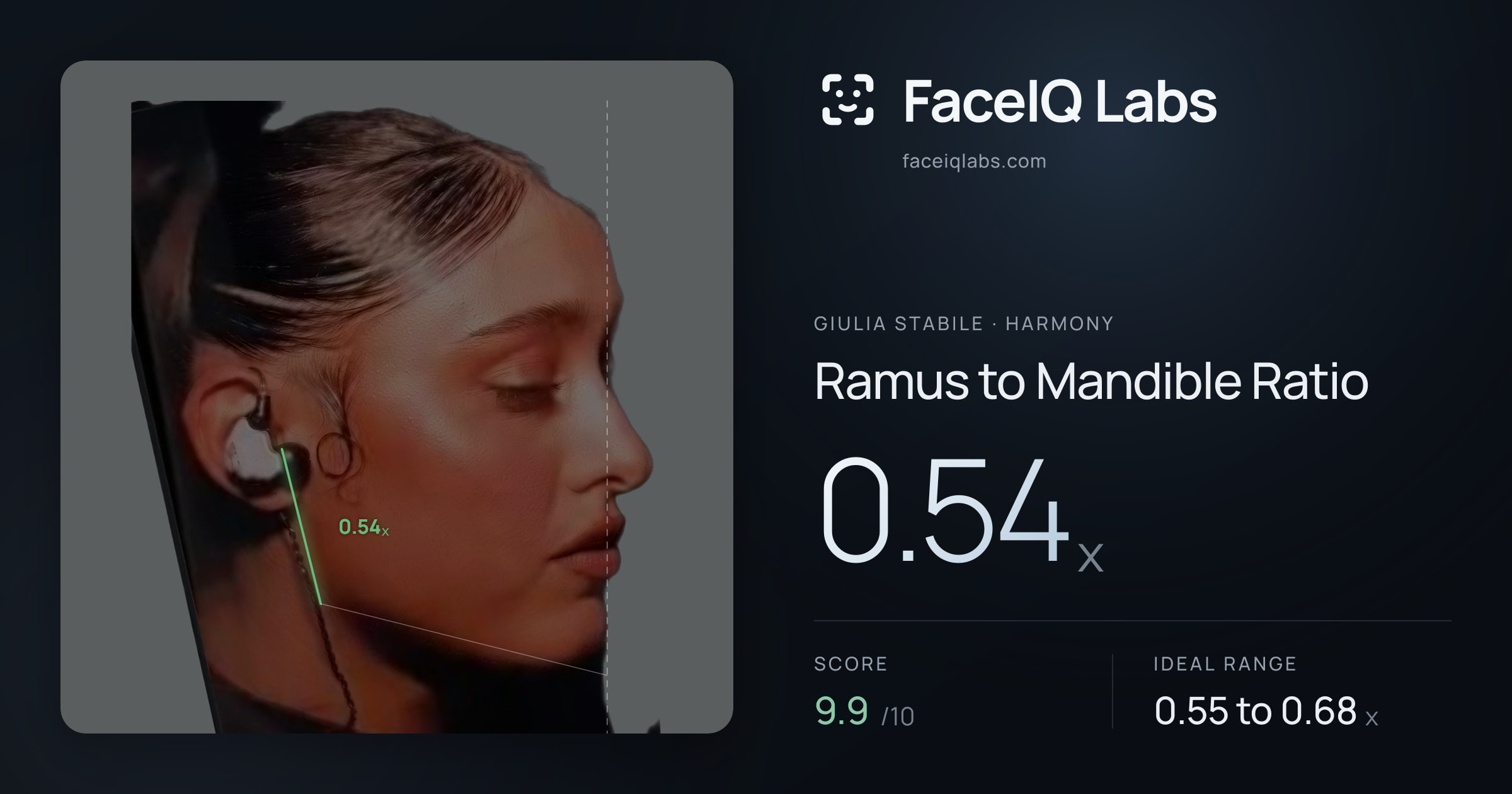 Giulia Stabile Ramus to Mandible Ratio: 0.54x, drawn on the photo