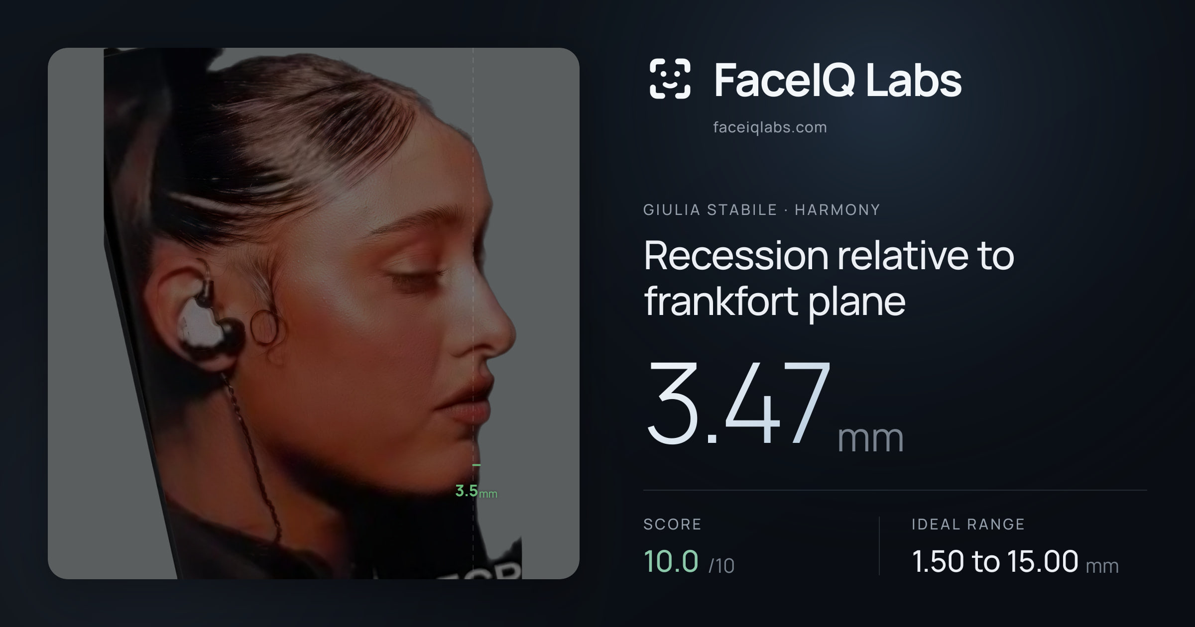 Giulia Stabile Recession relative to frankfort plane: 3.47mm, drawn on the photo