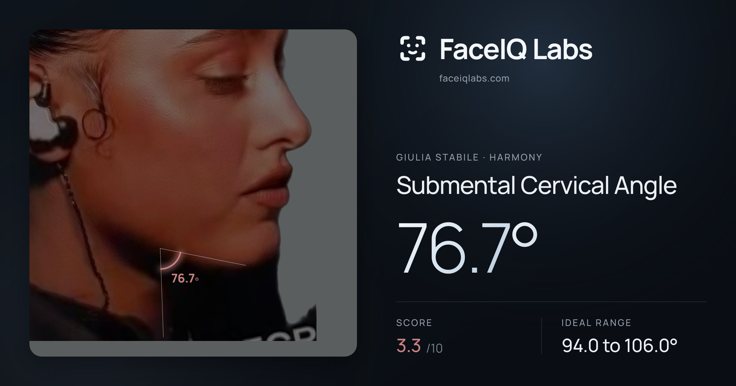 Giulia Stabile Submental Cervical Angle: 76.7°, drawn on the photo