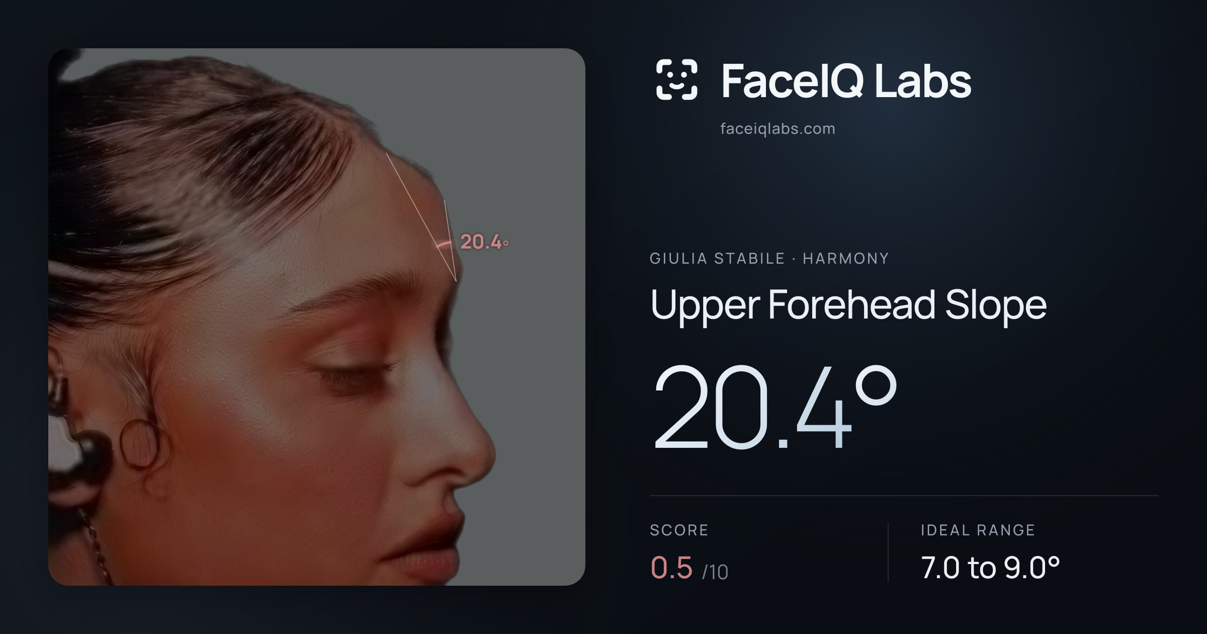 Giulia Stabile Upper Forehead Slope: 20.4°, drawn on the photo