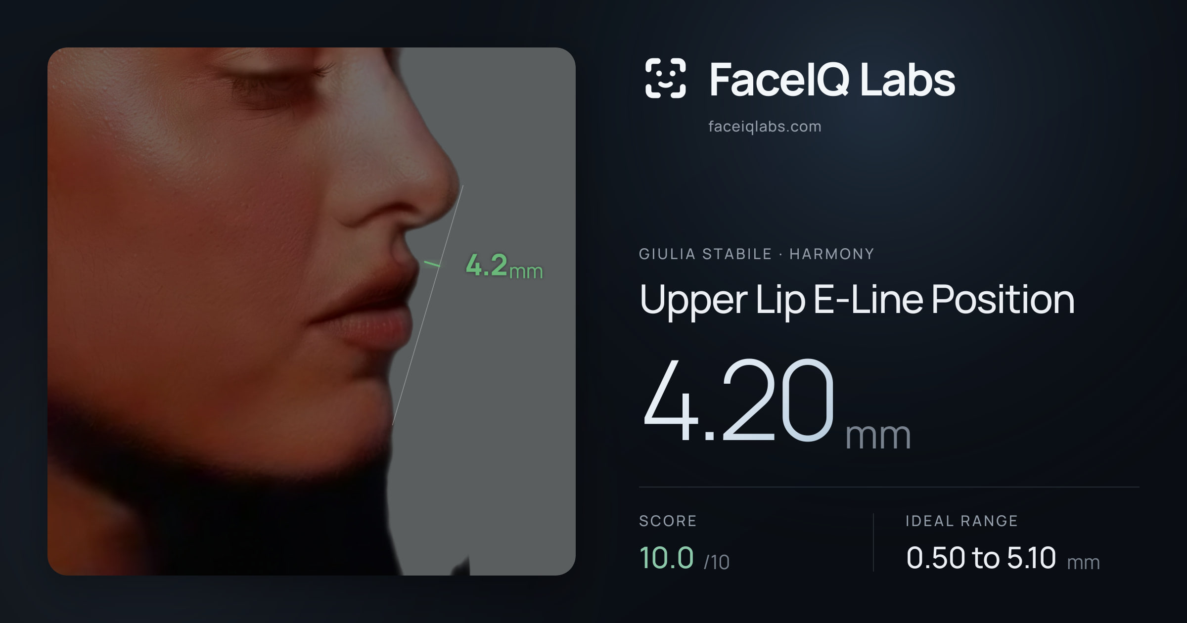 Giulia Stabile Upper Lip E-Line Position: 4.20mm, drawn on the photo