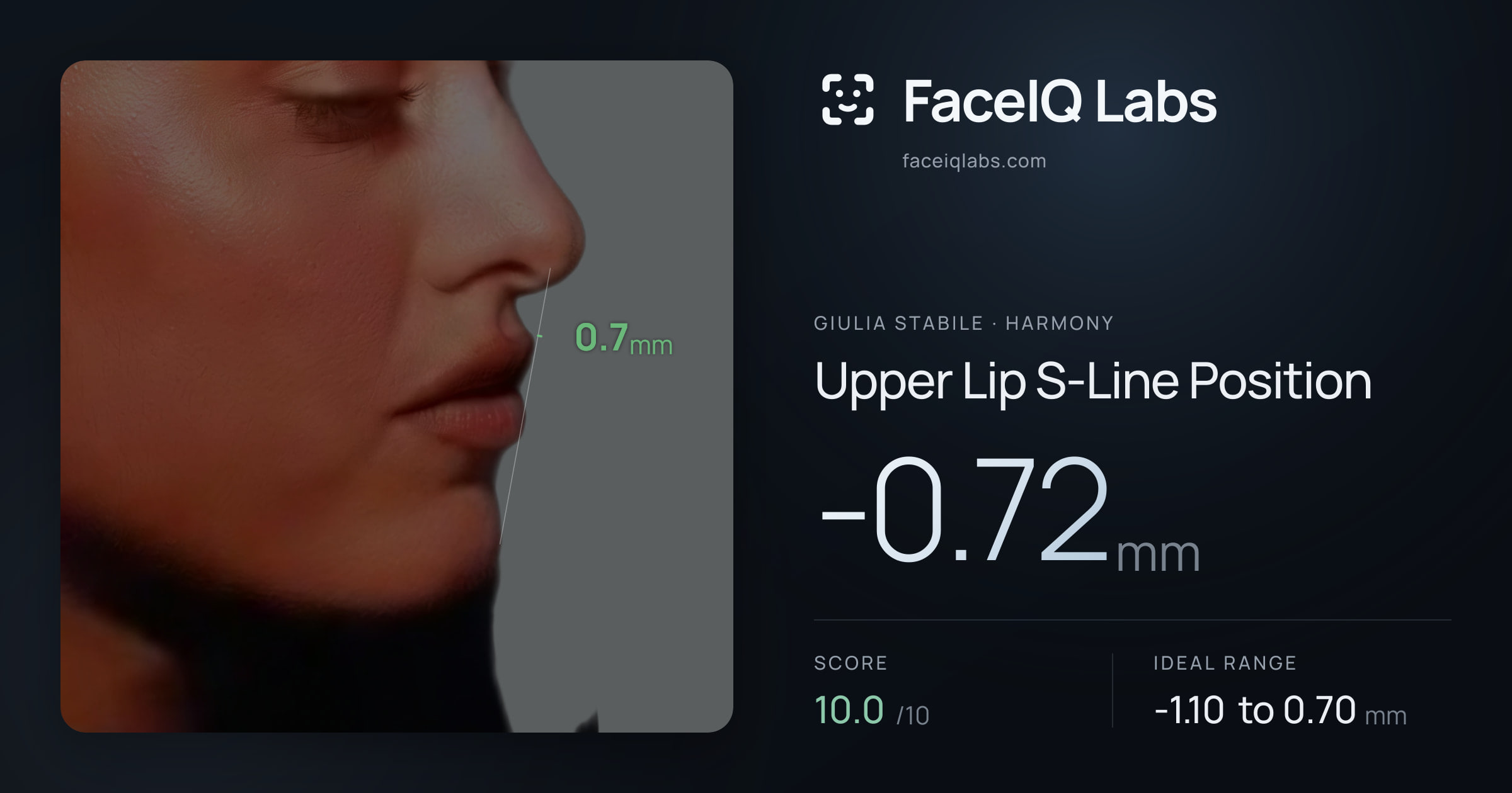 Giulia Stabile Upper Lip S-Line Position: -0.72mm, drawn on the photo