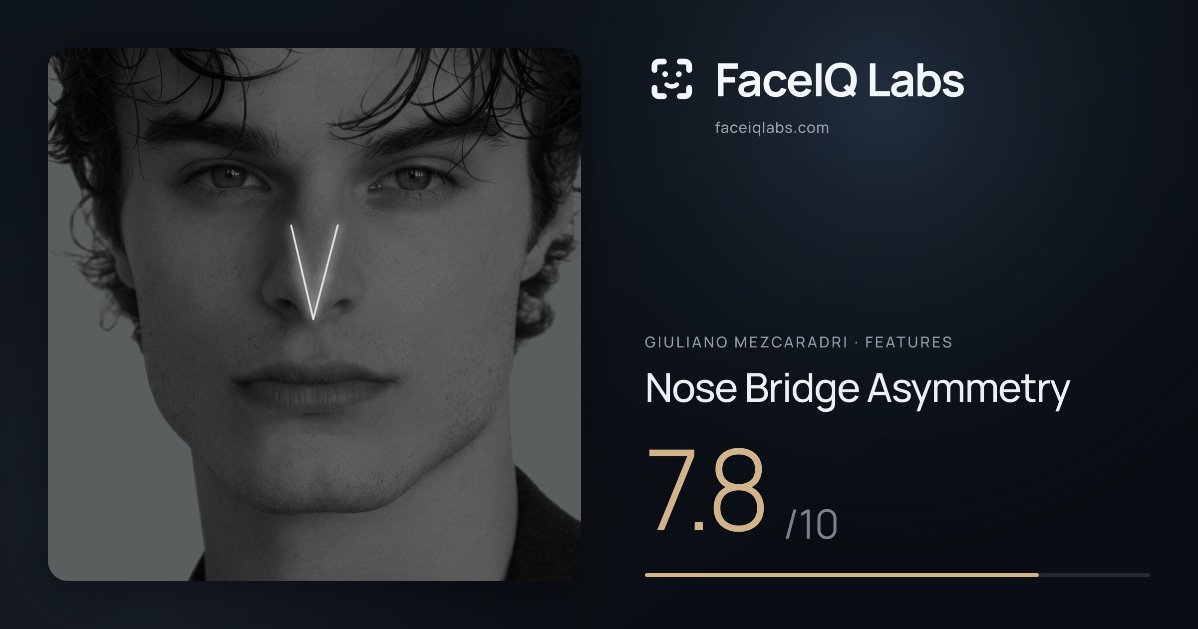 Giuliano Mezcaradri Nose Bridge Asymmetry: 7.8/10, drawn on the photo
