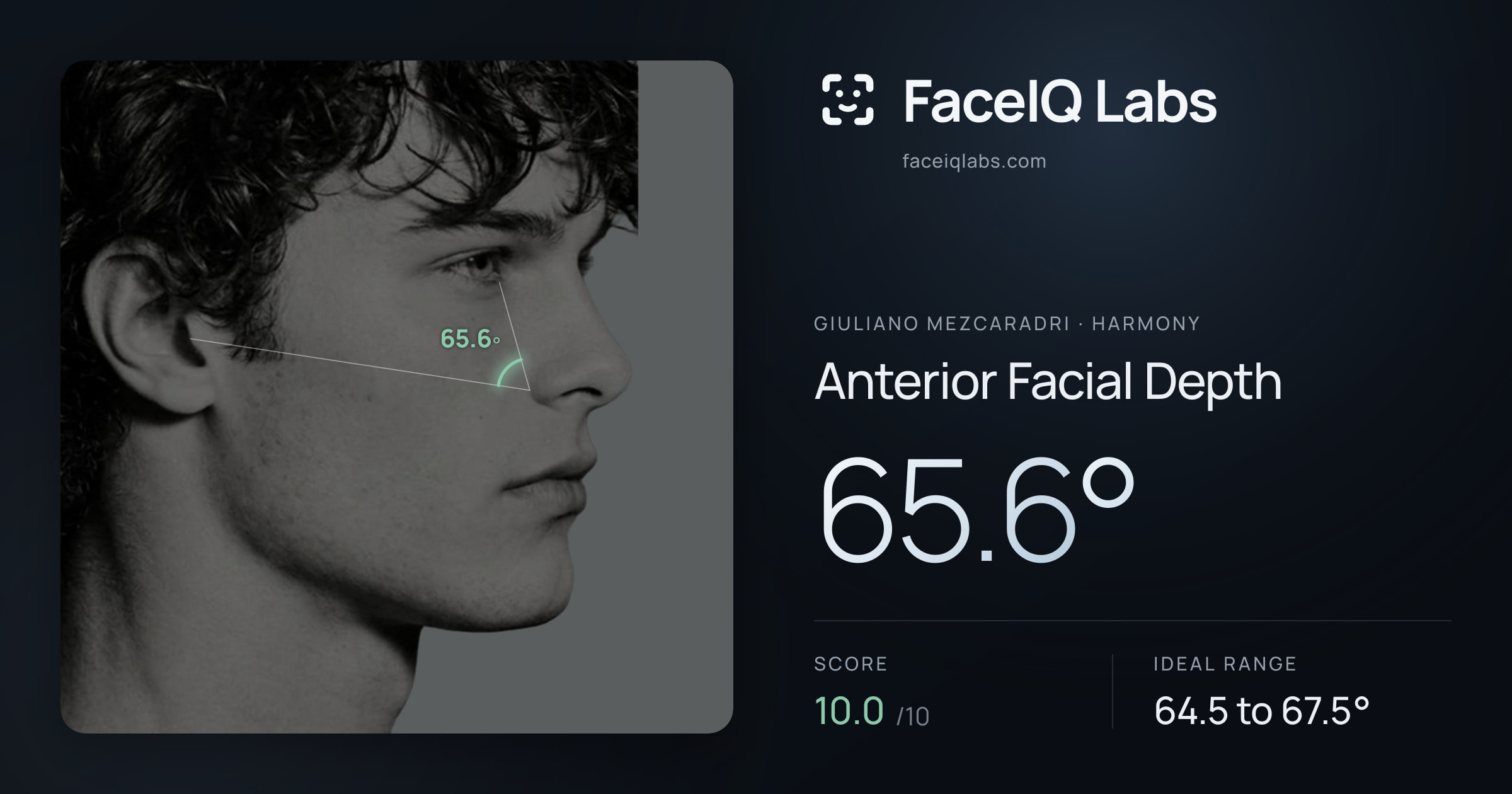 Giuliano Mezcaradri Anterior Facial Depth: 65.6°, drawn on the photo