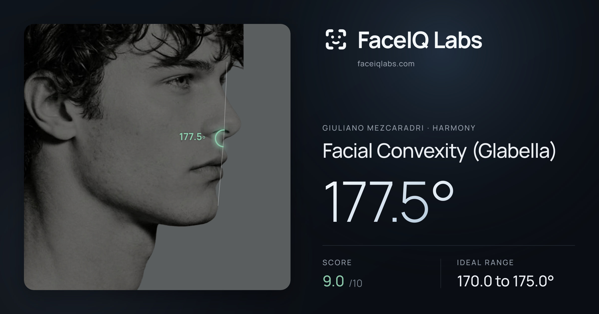 Giuliano Mezcaradri Facial Convexity (Glabella): 177.5°, drawn on the photo