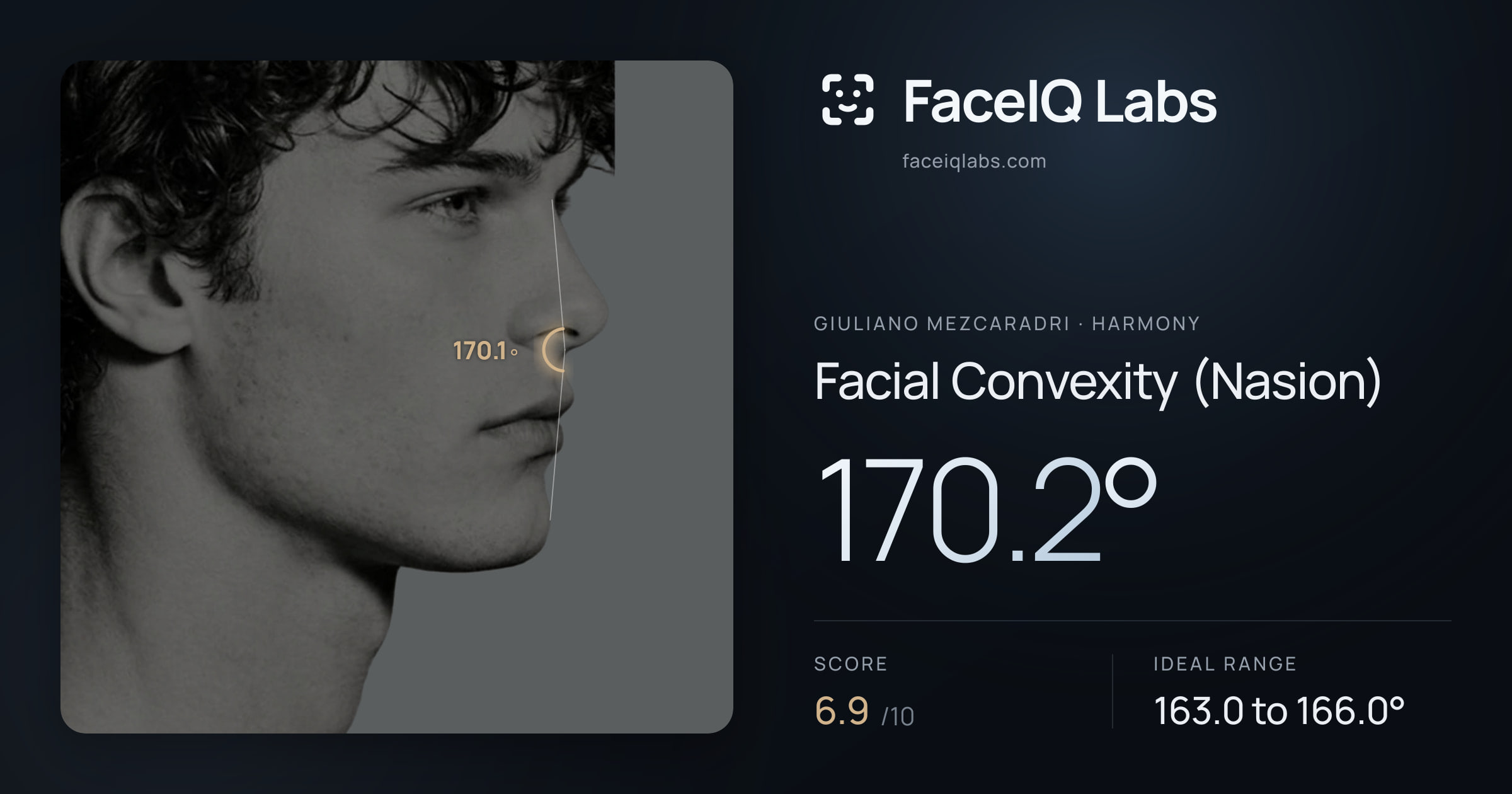 Giuliano Mezcaradri Facial Convexity (Nasion): 170.2°, drawn on the photo