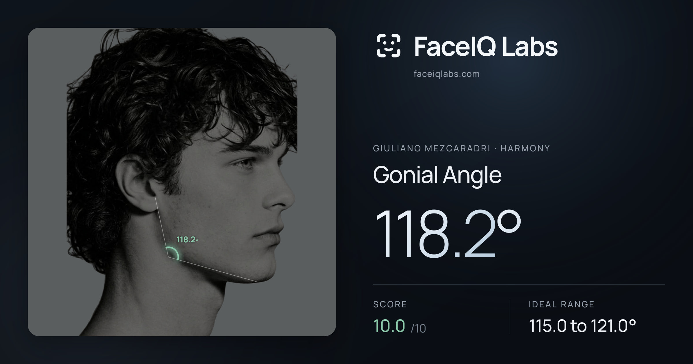 Giuliano Mezcaradri Gonial Angle: 118.2°, drawn on the photo