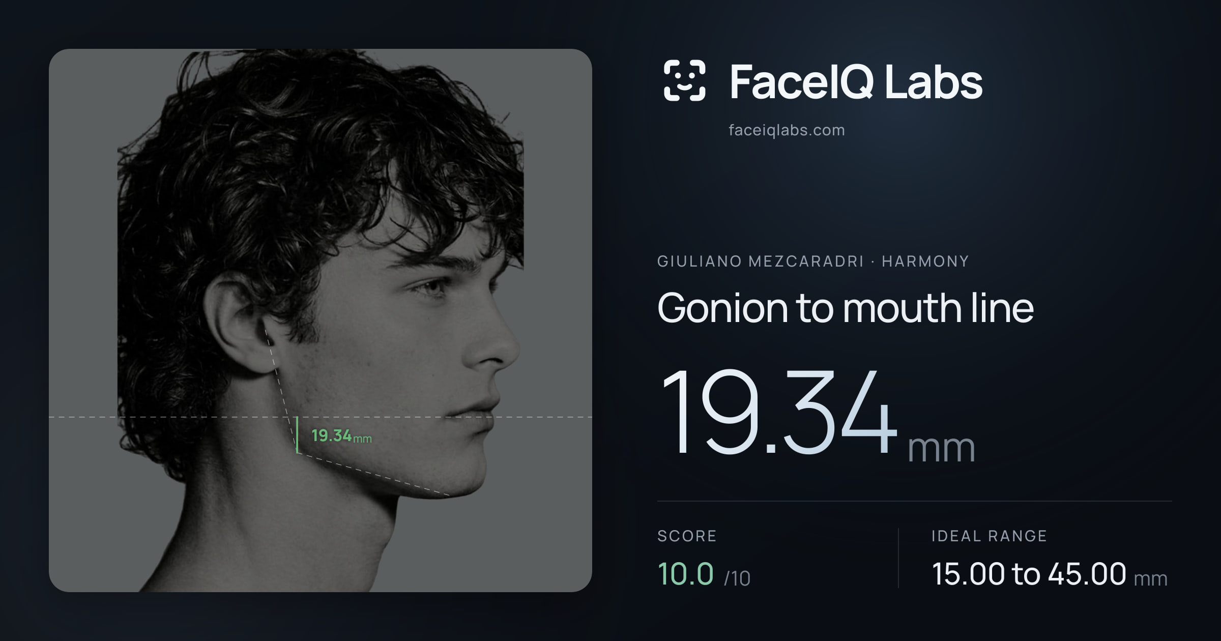 Giuliano Mezcaradri Gonion to mouth line: 19.34mm, drawn on the photo