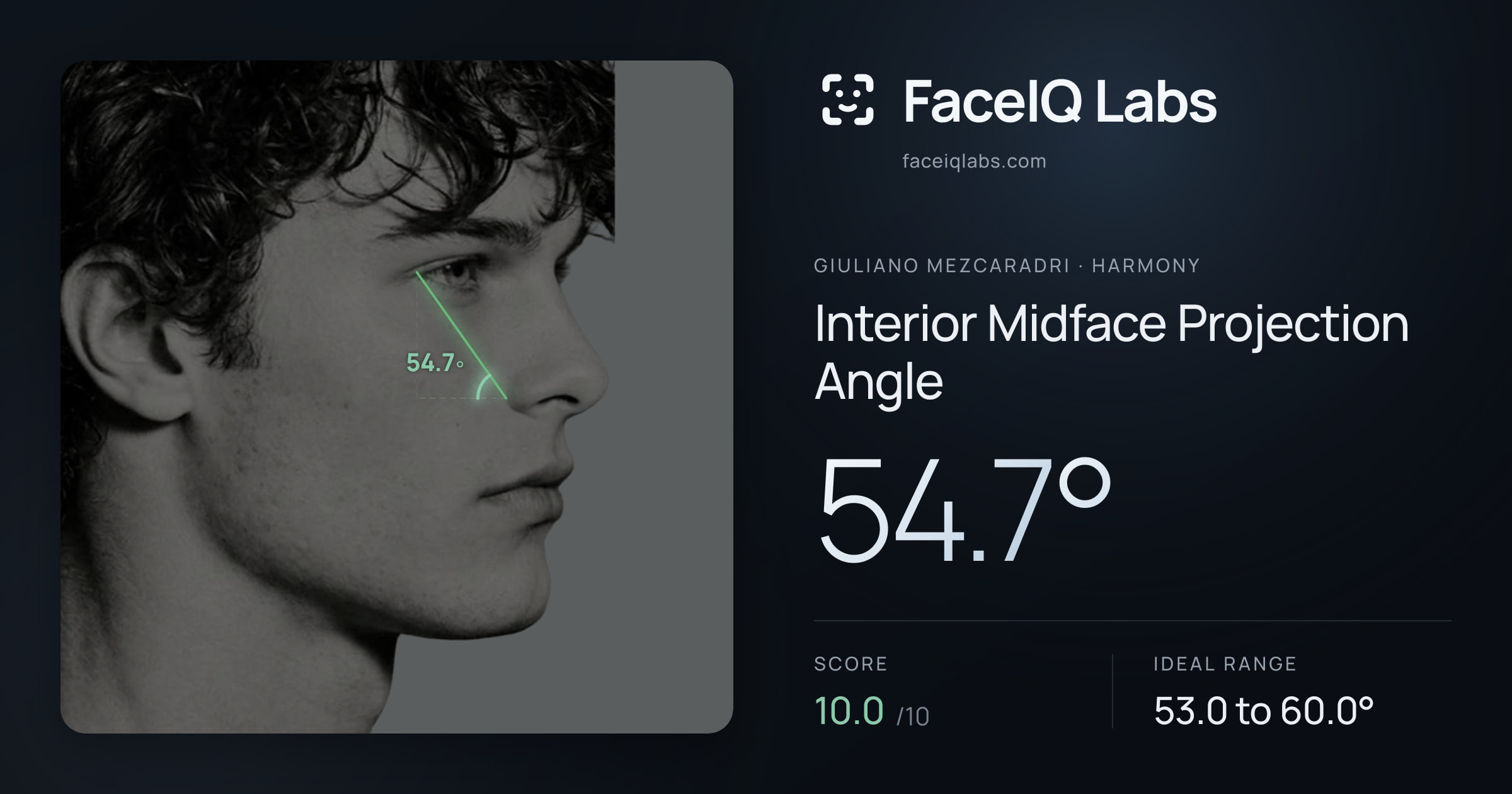 Giuliano Mezcaradri Interior Midface Projection Angle: 54.7°, drawn on the photo