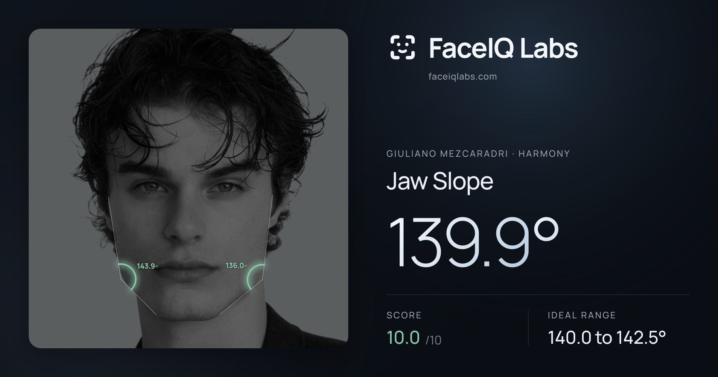 Giuliano Mezcaradri Jaw Slope: 148.4°, drawn on the photo
