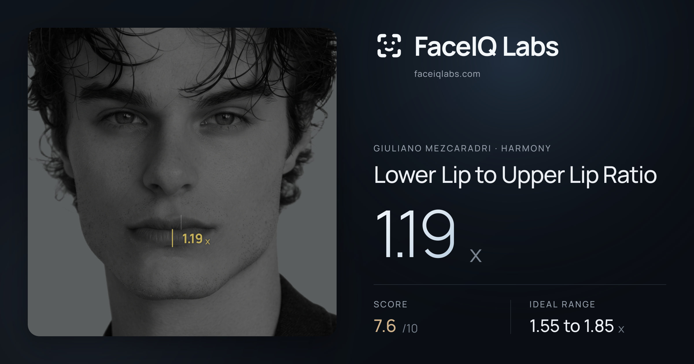 Giuliano Mezcaradri Lower Lip to Upper Lip Ratio: 1.44x, drawn on the photo