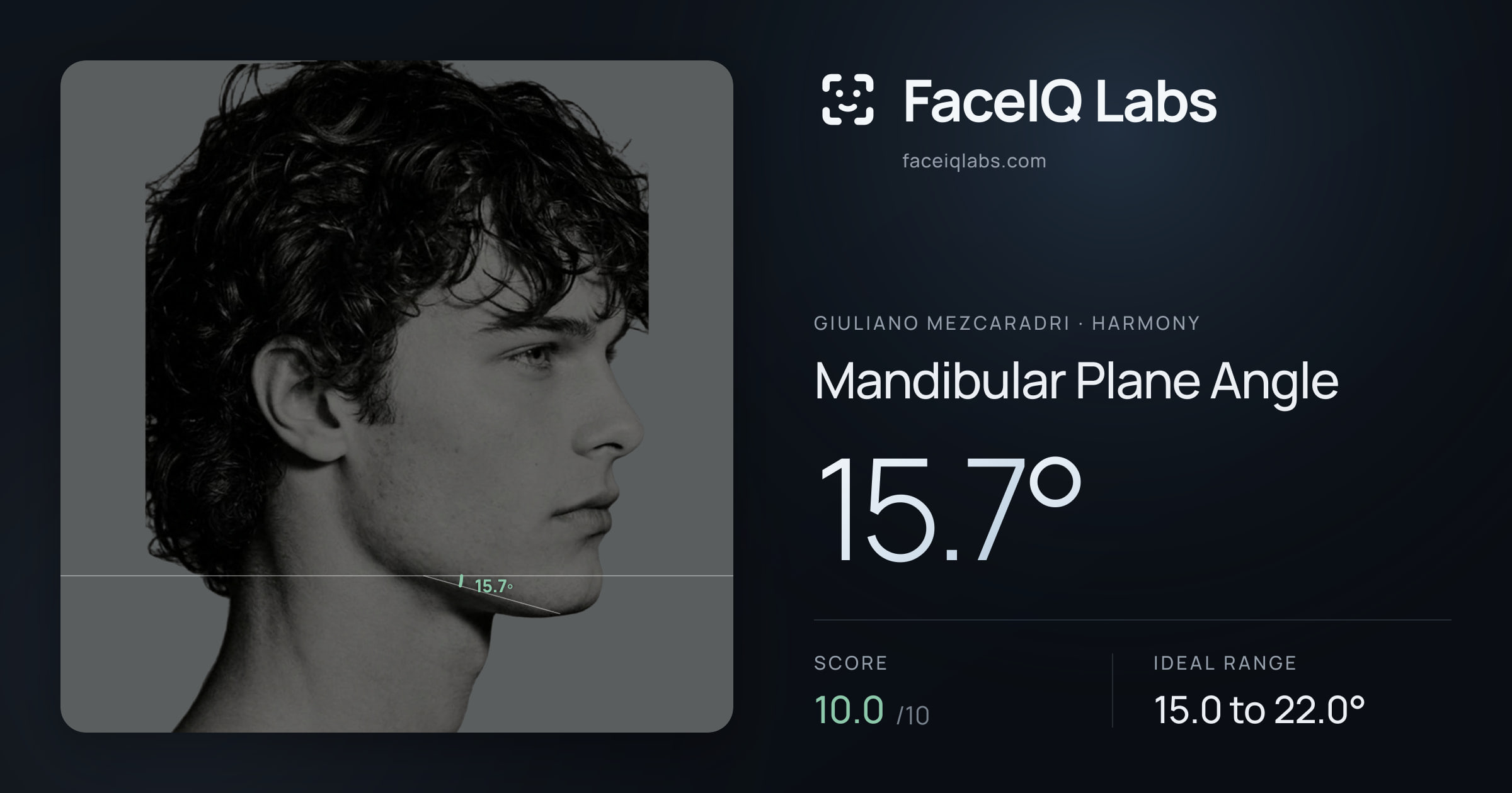 Giuliano Mezcaradri Mandibular Plane Angle: 15.7°, drawn on the photo