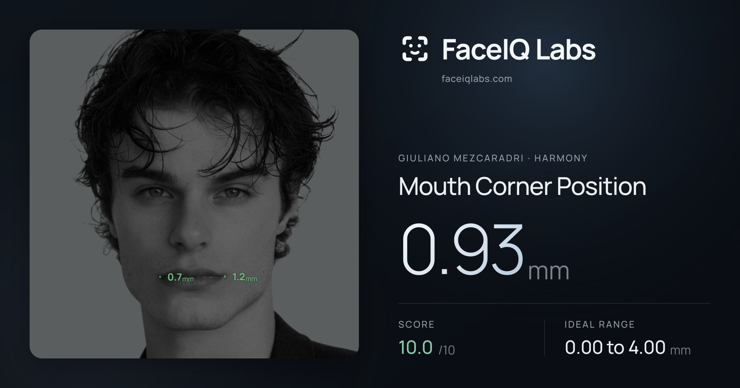 Giuliano Mezcaradri Mouth Corner Position: 3.18mm, drawn on the photo