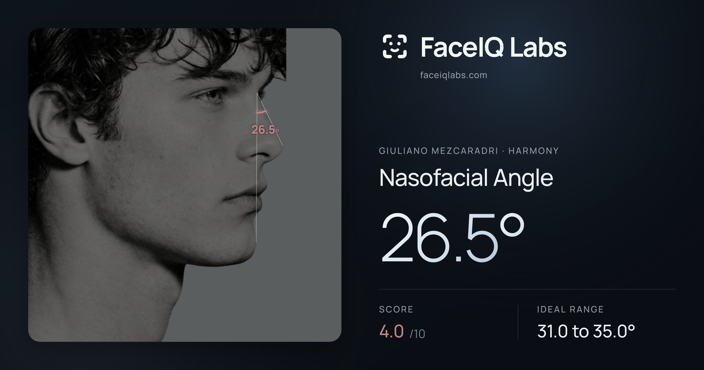 Giuliano Mezcaradri Nasofacial Angle: 26.5°, drawn on the photo