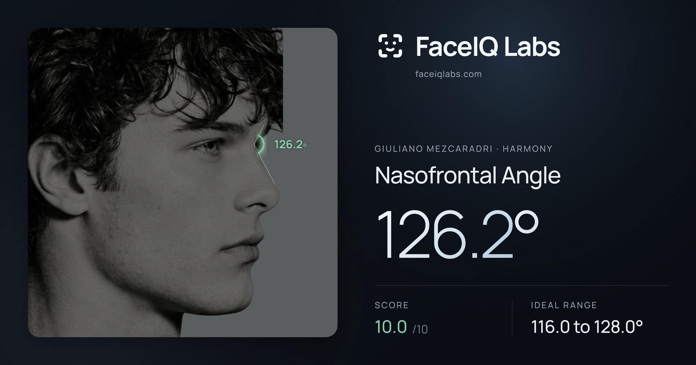 Giuliano Mezcaradri Nasofrontal Angle: 126.2°, drawn on the photo