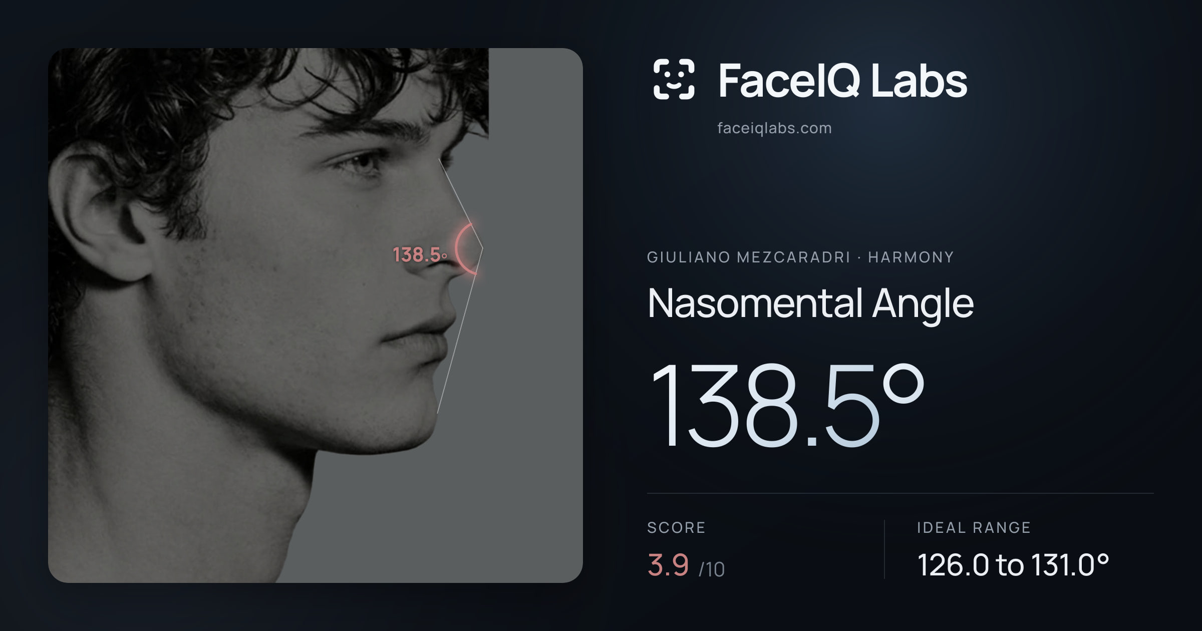 Giuliano Mezcaradri Nasomental Angle: 138.5°, drawn on the photo