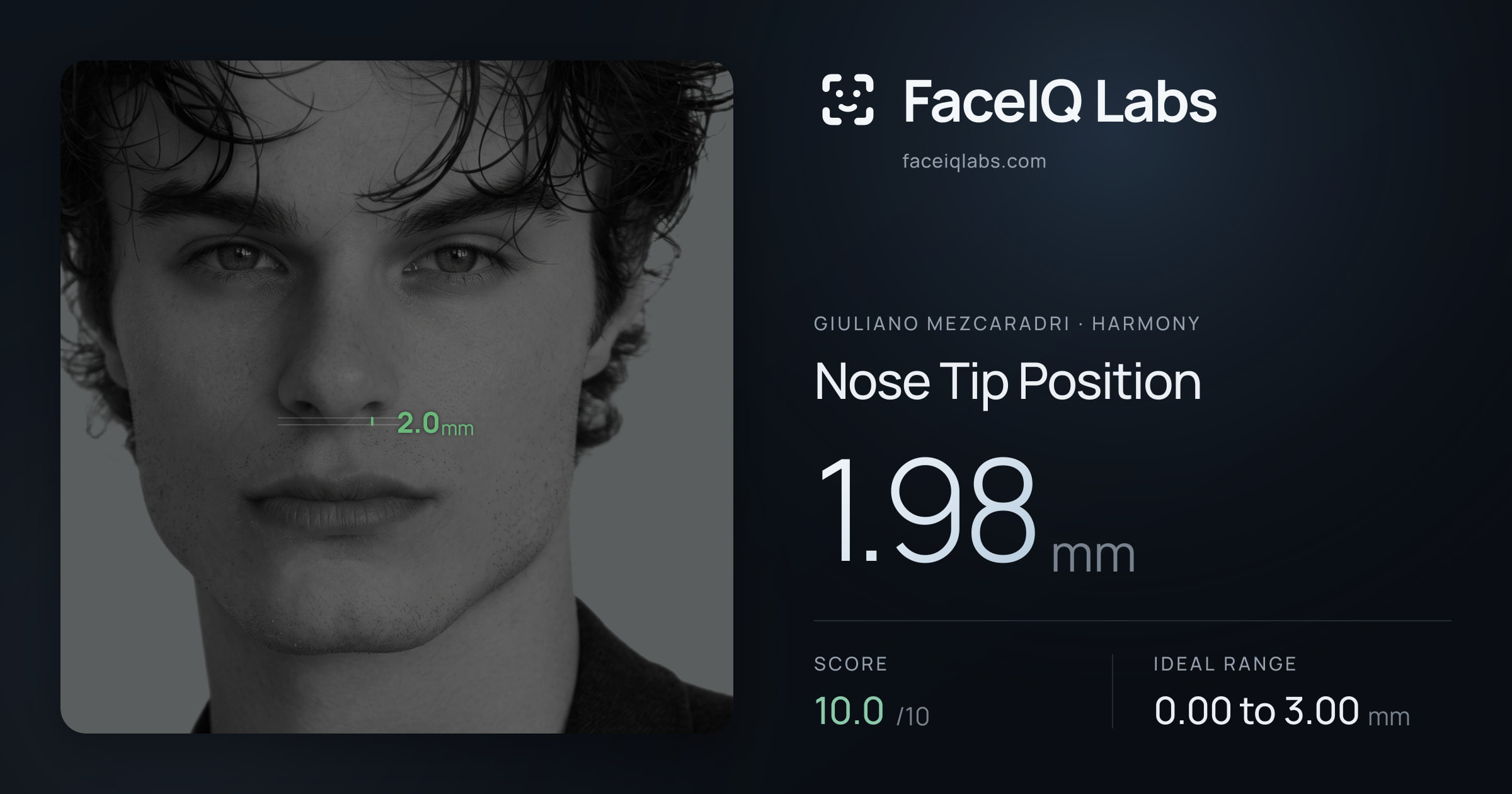 Giuliano Mezcaradri Nose Tip Position: 4.00mm, drawn on the photo