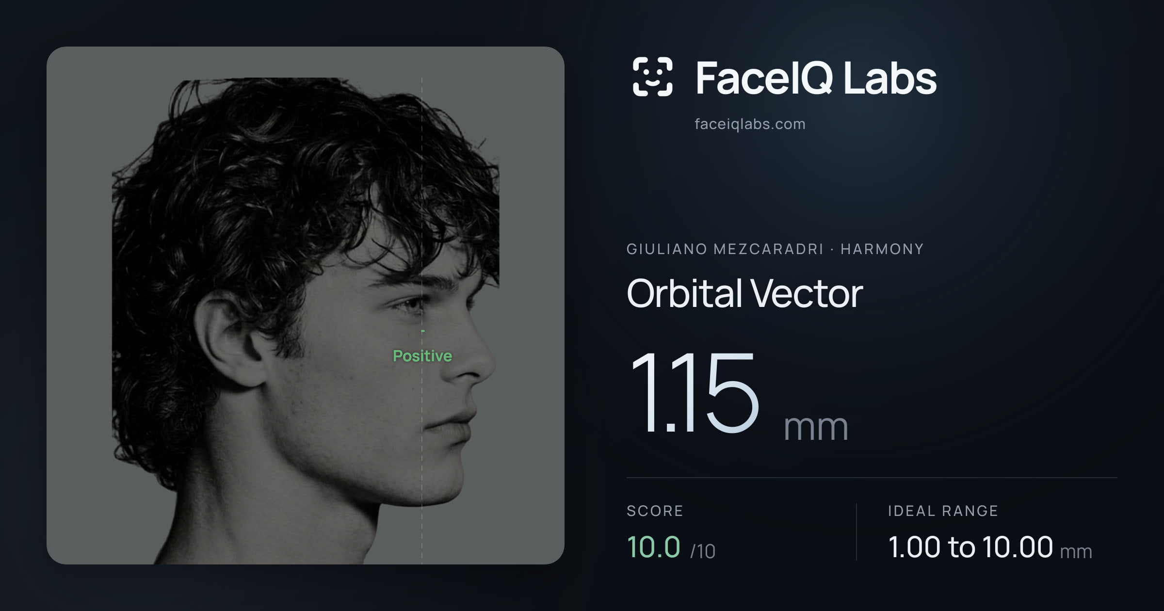 Giuliano Mezcaradri Orbital Vector: 1.15mm, drawn on the photo