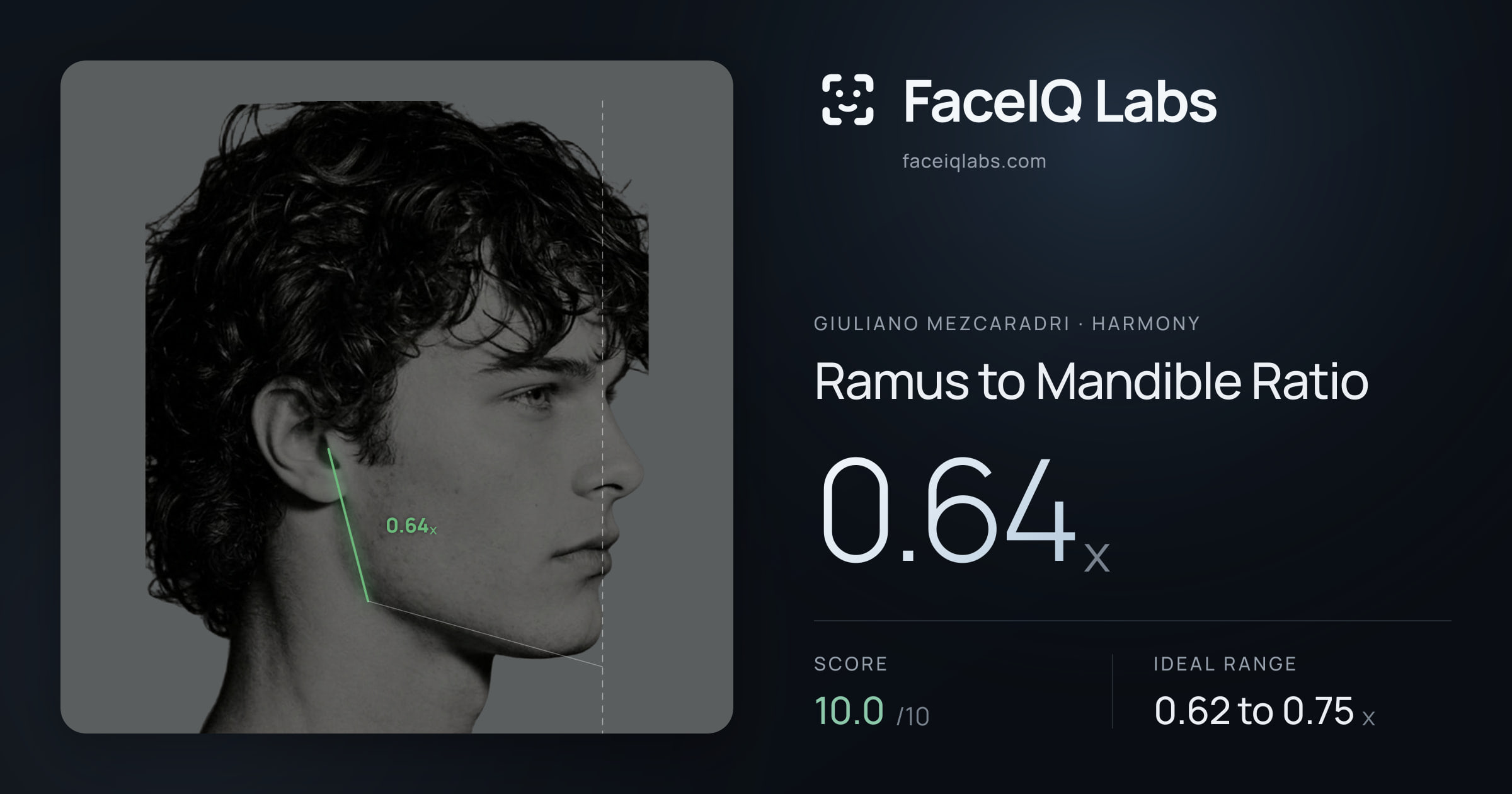Giuliano Mezcaradri Ramus to Mandible Ratio: 0.64x, drawn on the photo