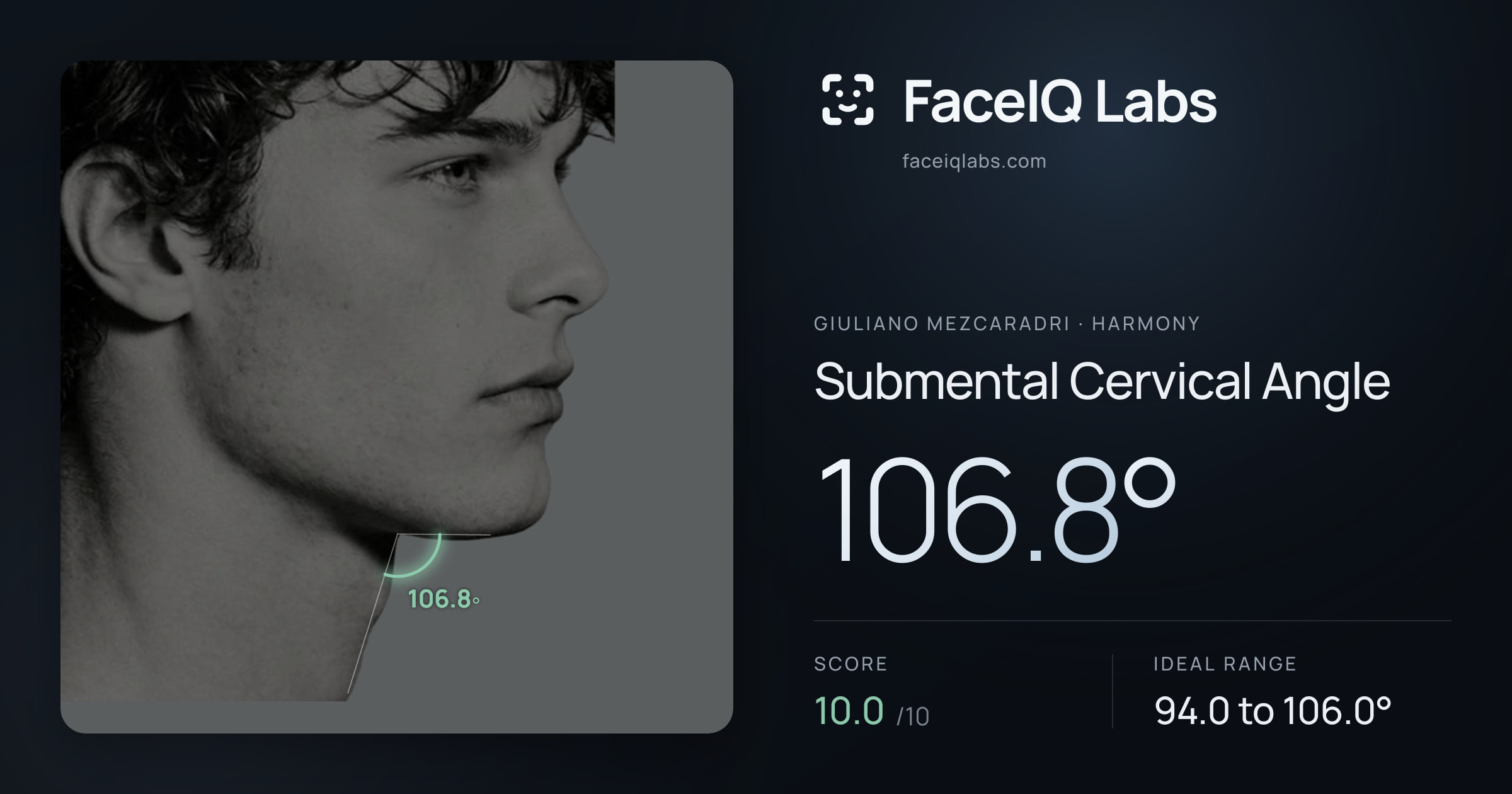 Giuliano Mezcaradri Submental Cervical Angle: 106.8°, drawn on the photo