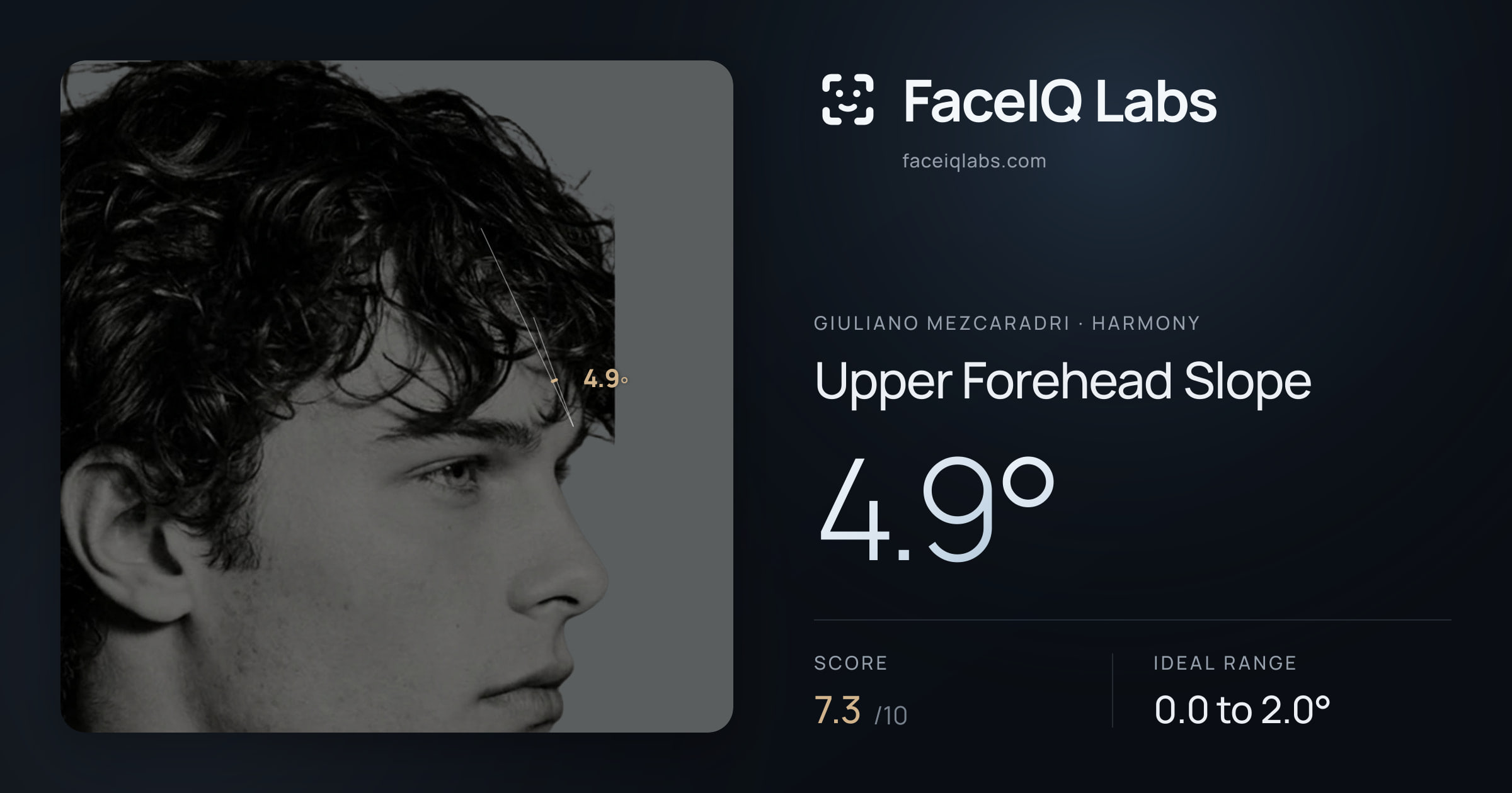 Giuliano Mezcaradri Upper Forehead Slope: 4.9°, drawn on the photo