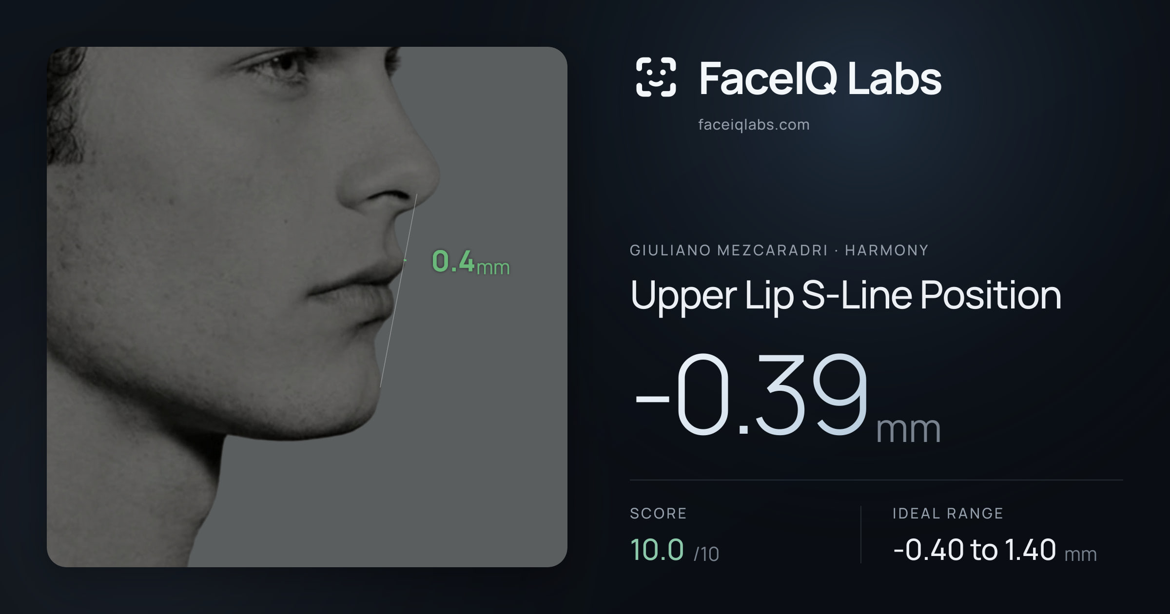 Giuliano Mezcaradri Upper Lip S-Line Position: -0.39mm, drawn on the photo