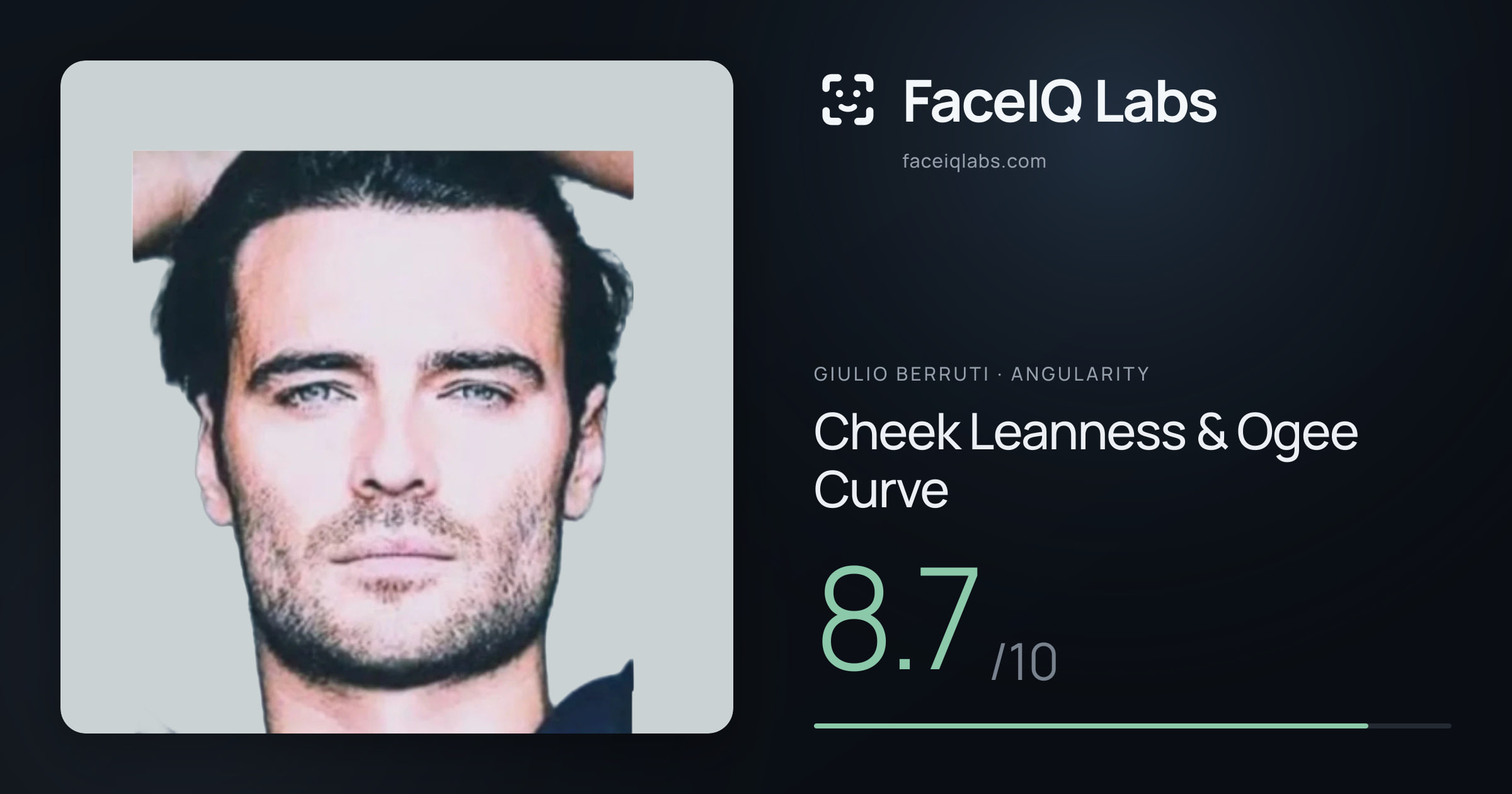 Giulio Berruti Cheek Leanness & Ogee Curve: 8.7/10, drawn on the photo