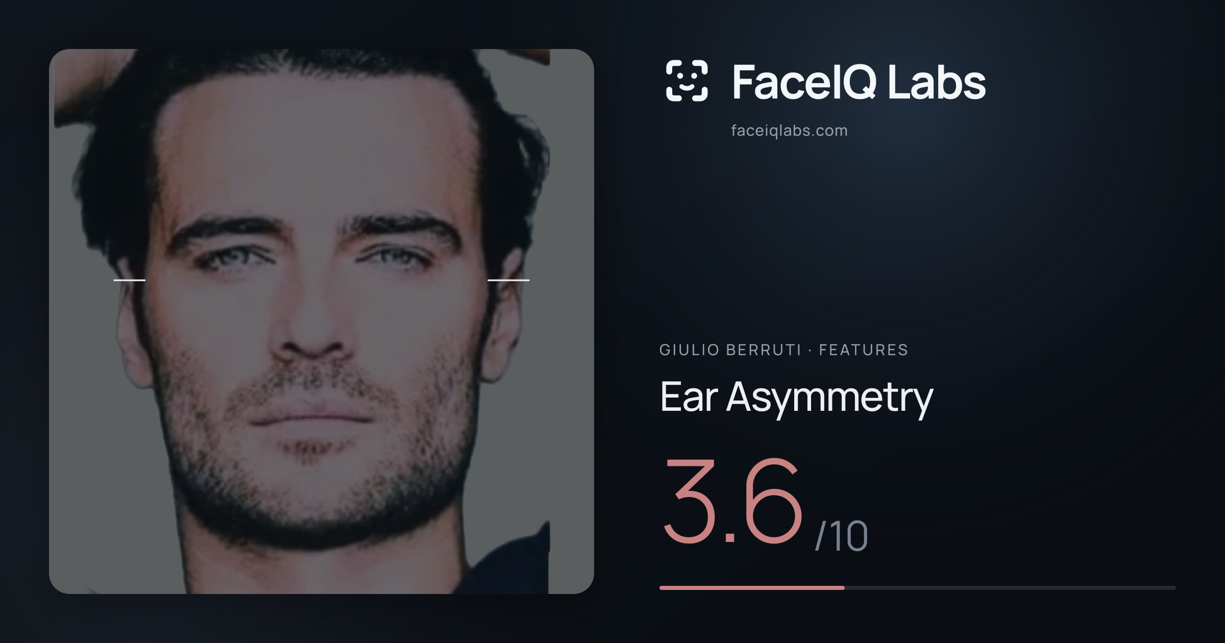 Giulio Berruti Ear Asymmetry: 3.6/10, drawn on the photo