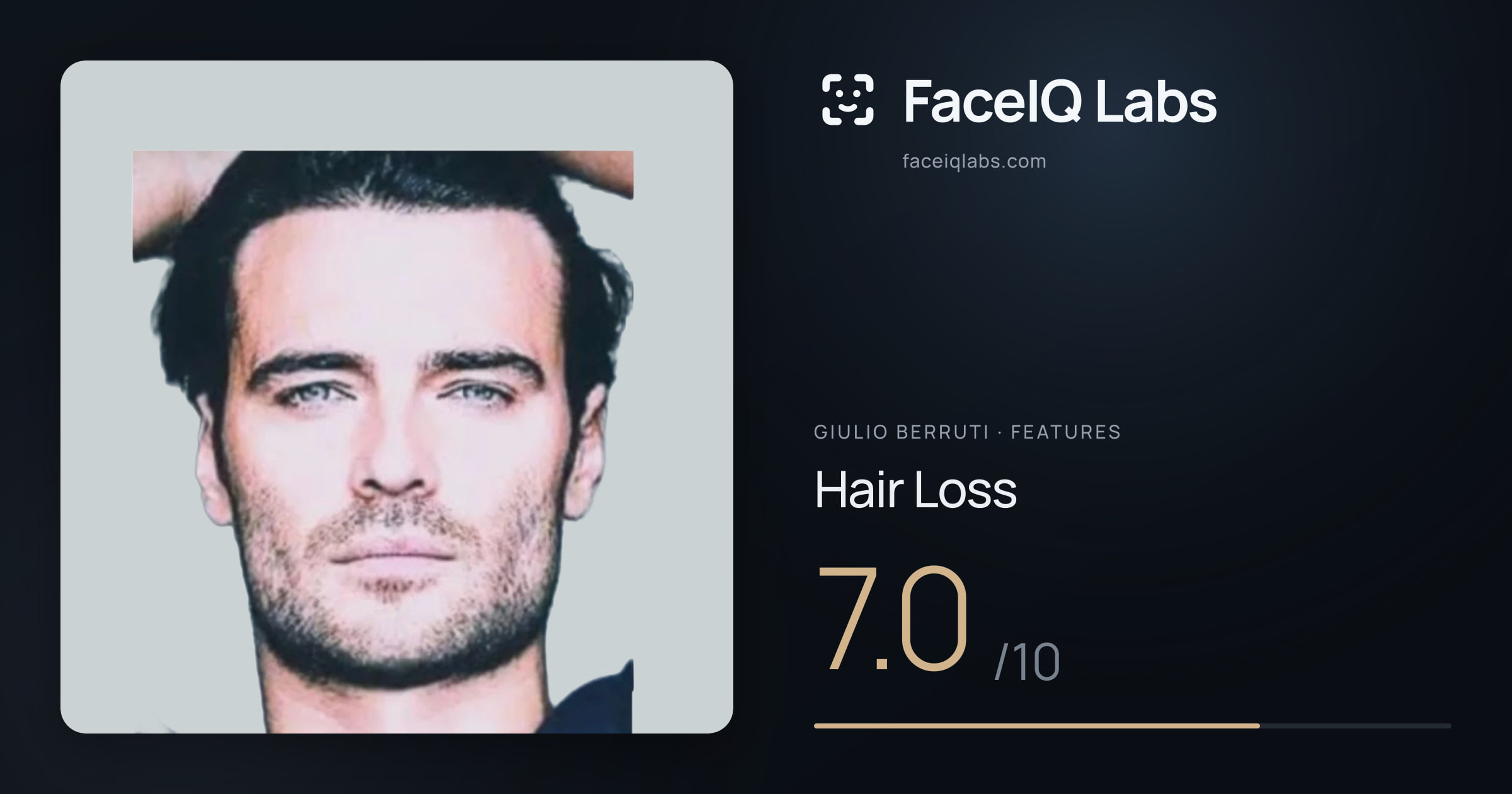 Giulio Berruti Hair Loss: 7.0/10, drawn on the photo
