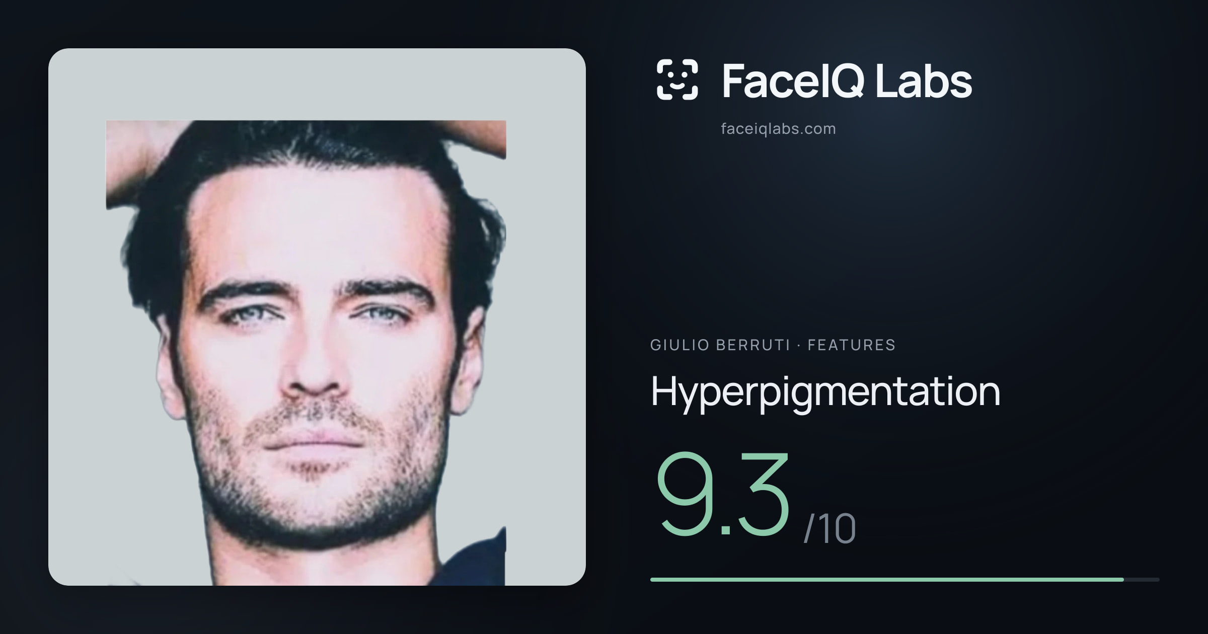 Giulio Berruti Hyperpigmentation: 9.3/10, drawn on the photo