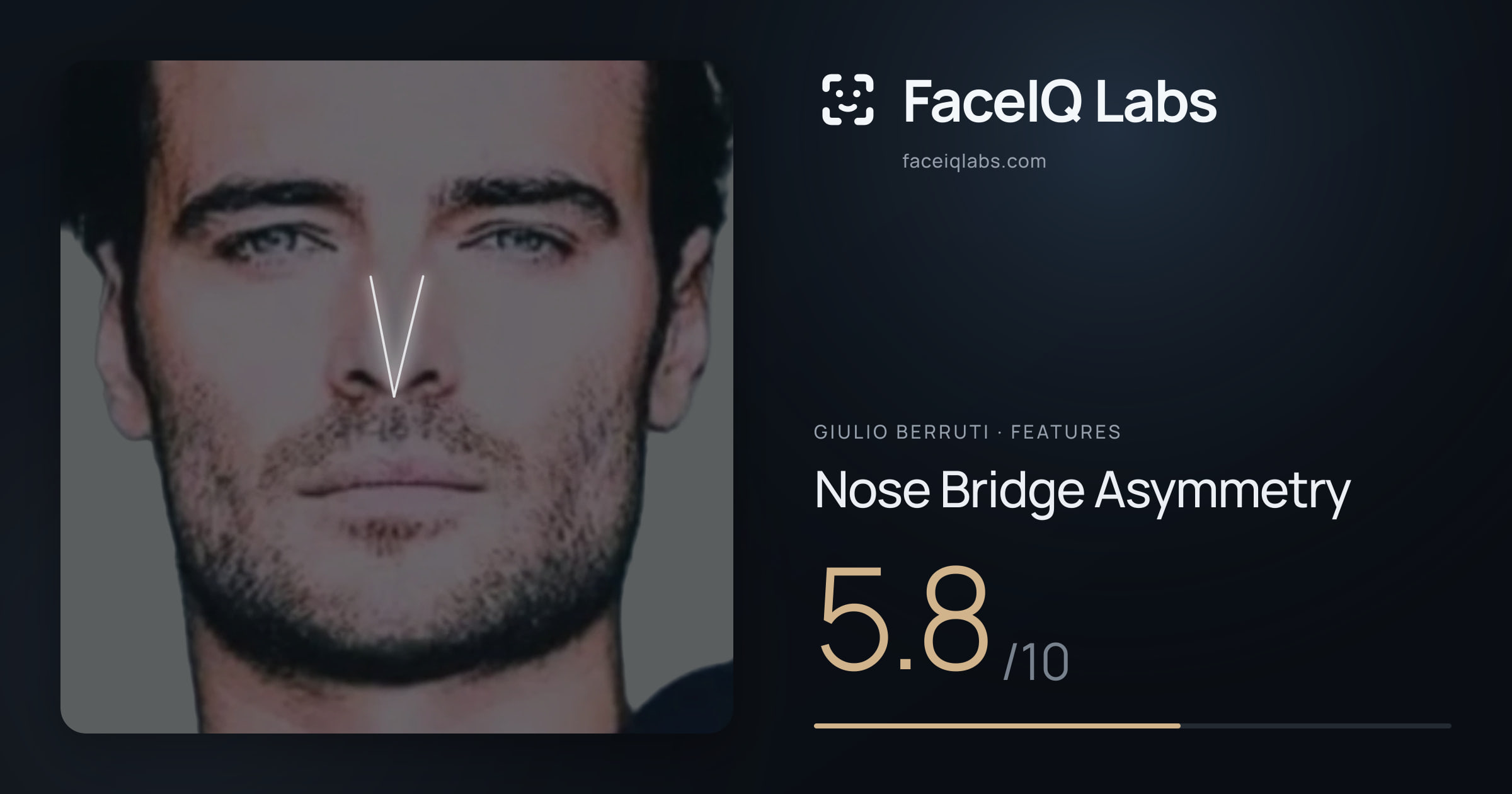 Giulio Berruti Nose Bridge Asymmetry: 5.8/10, drawn on the photo