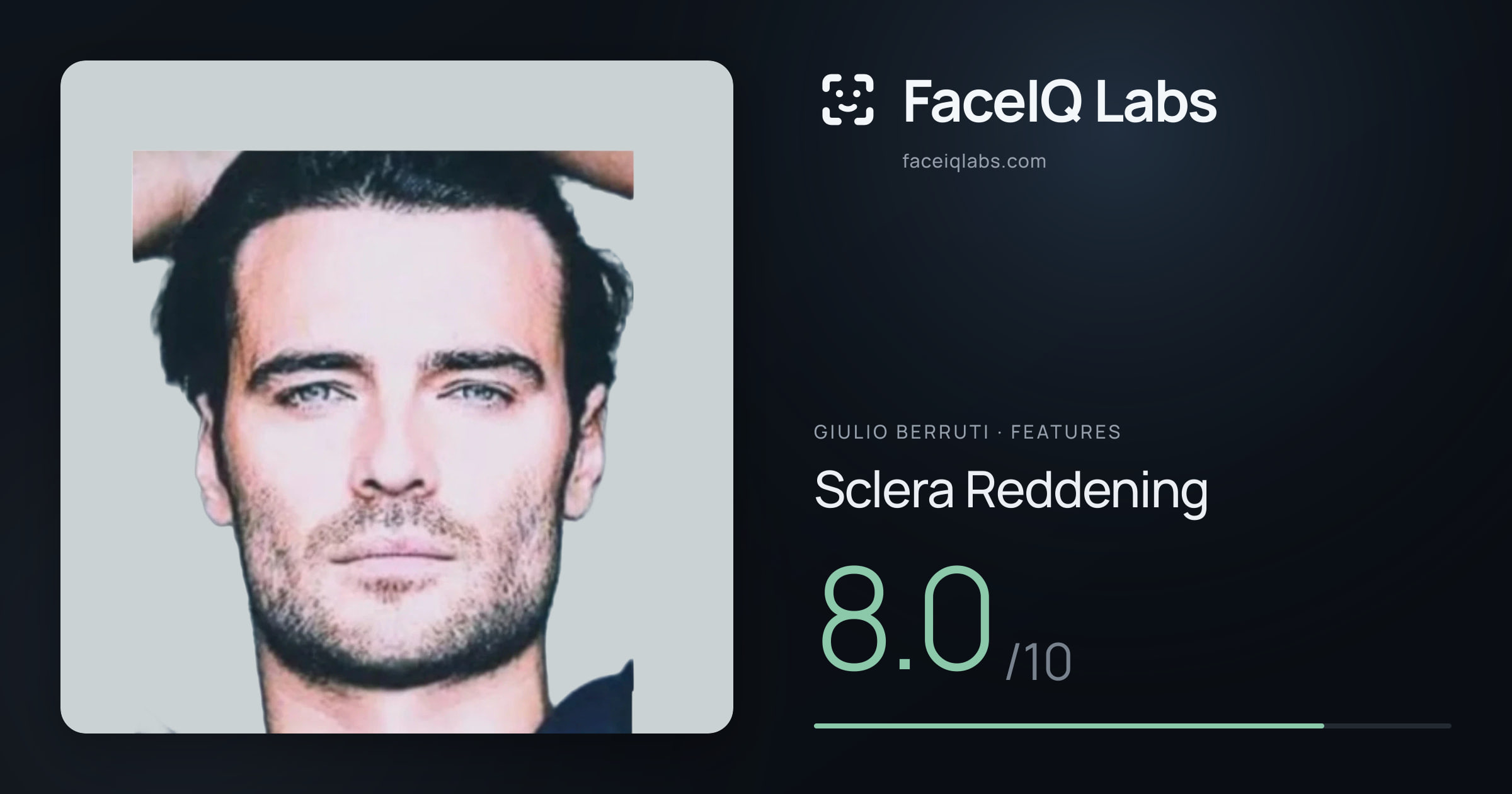 Giulio Berruti Sclera Reddening: 8.0/10, drawn on the photo