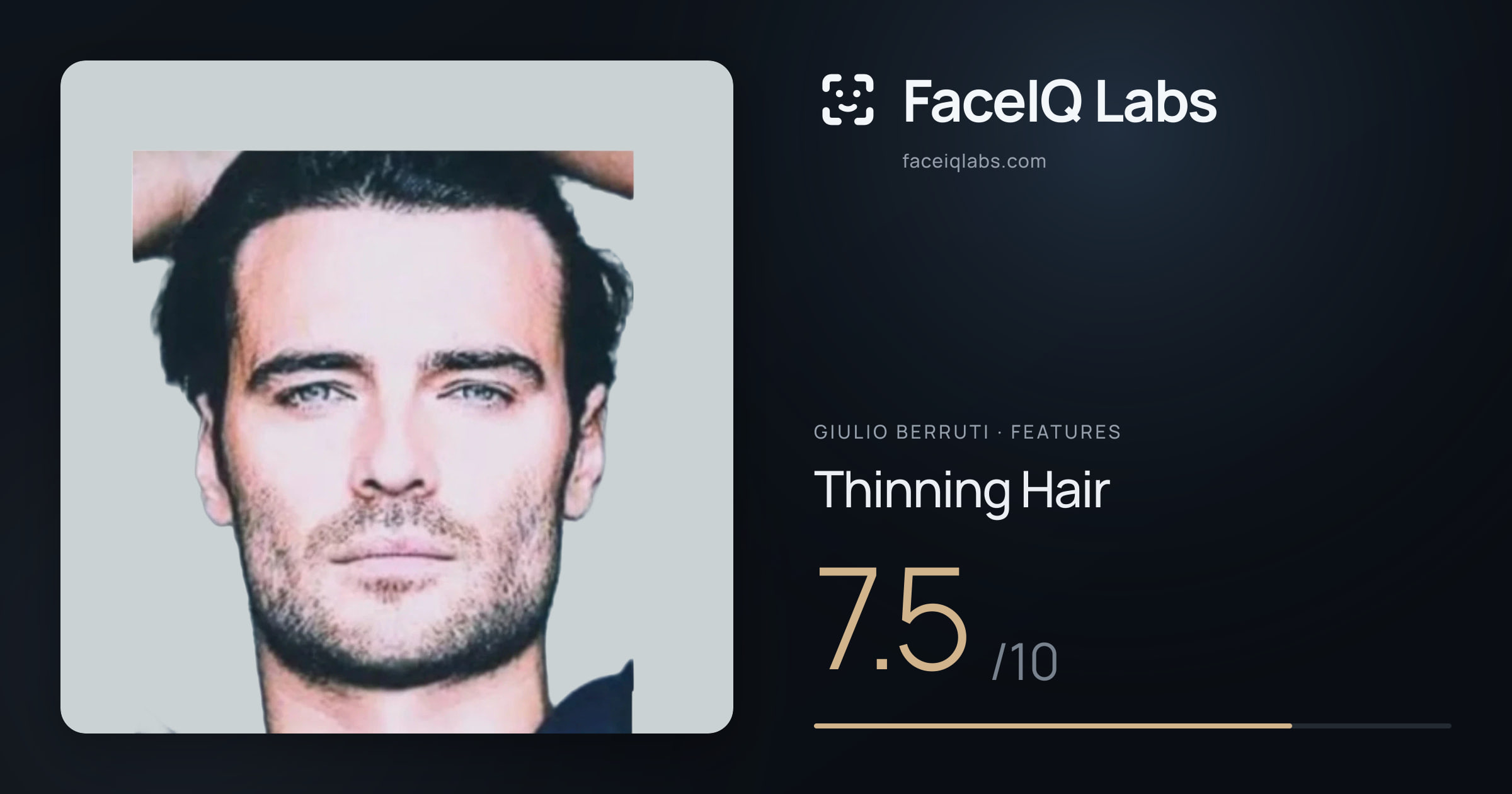 Giulio Berruti Thinning Hair: 7.5/10, drawn on the photo