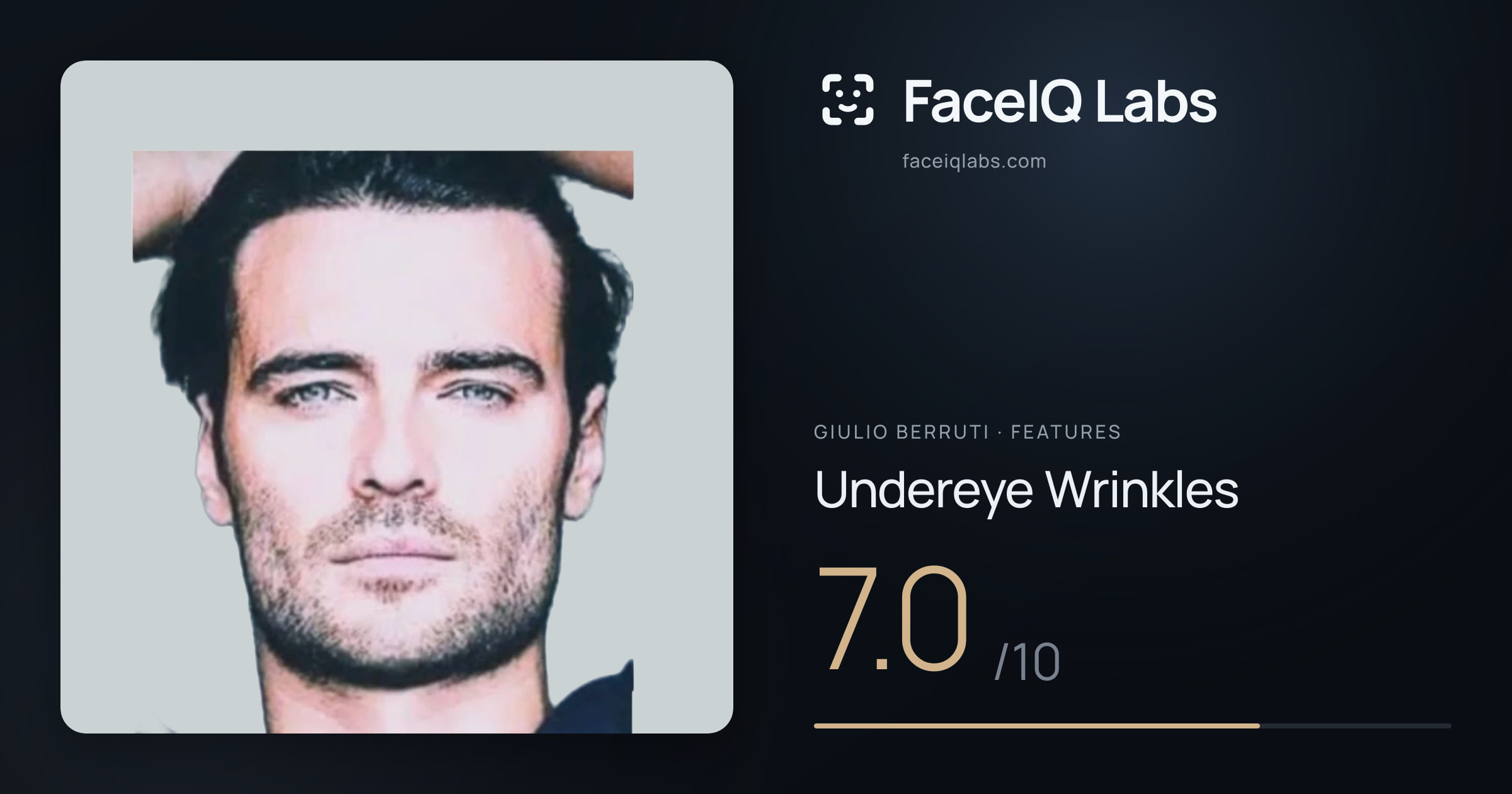 Giulio Berruti Undereye Wrinkles: 7.0/10, drawn on the photo