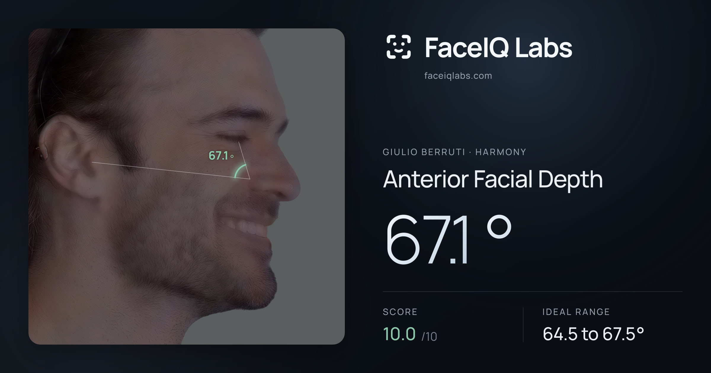 Giulio Berruti Anterior Facial Depth: 67.1°, drawn on the photo