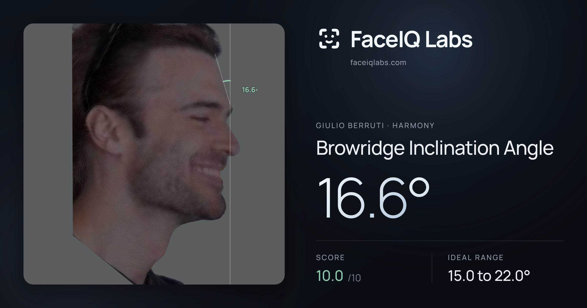 Giulio Berruti Browridge Inclination Angle: 16.6°, drawn on the photo