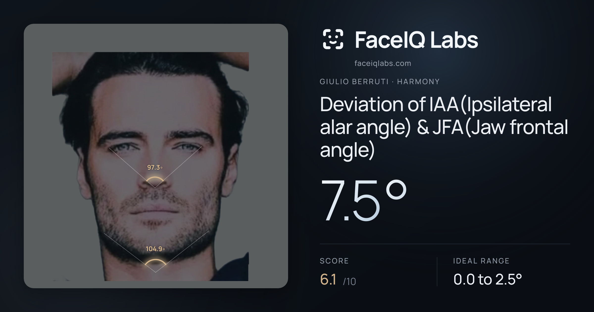 Giulio Berruti Deviation of IAA(Ipsilateral alar angle) & JFA(Jaw frontal angle): 7.5°, drawn on the photo