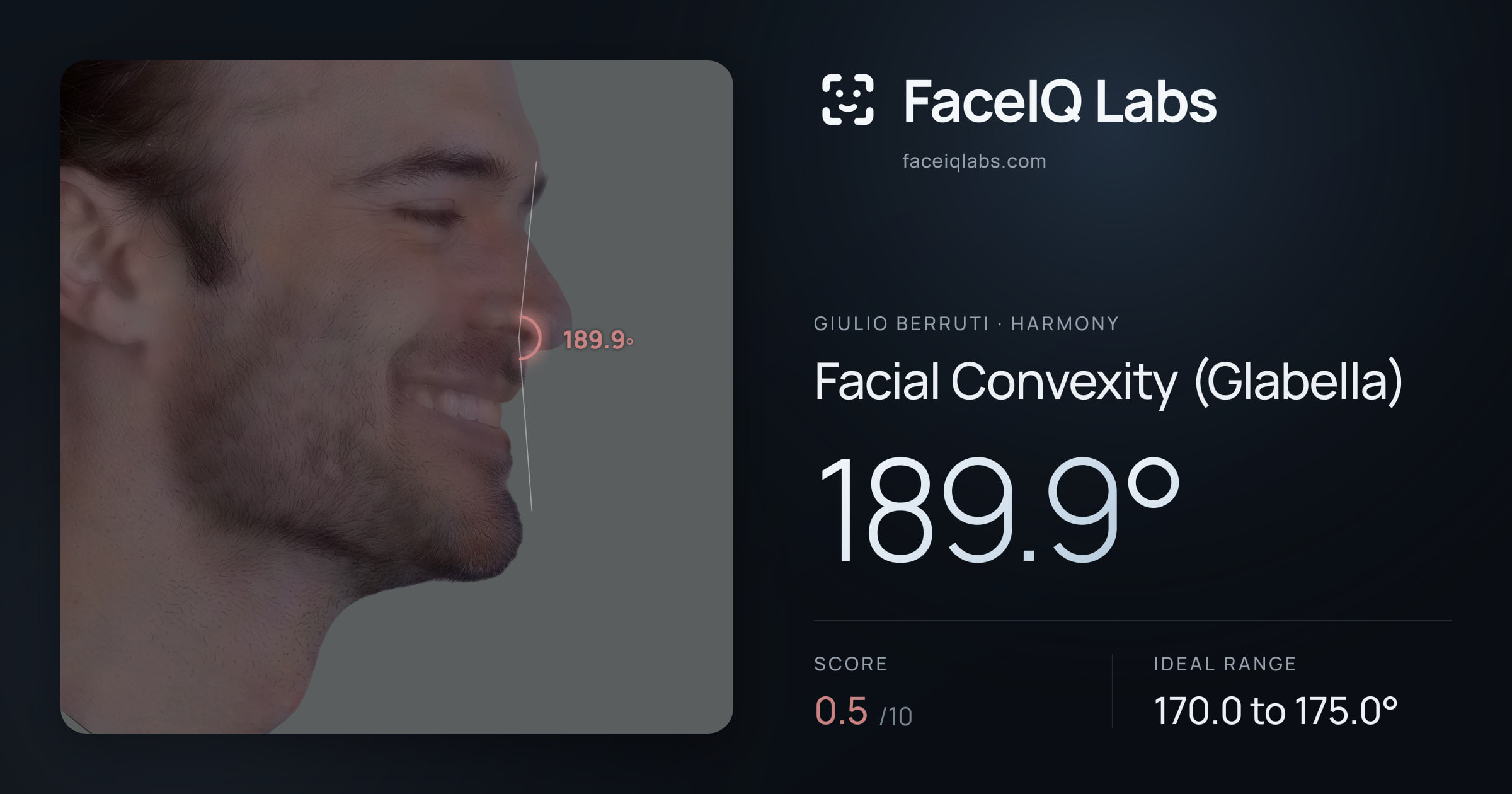 Giulio Berruti Facial Convexity (Glabella): 189.9°, drawn on the photo