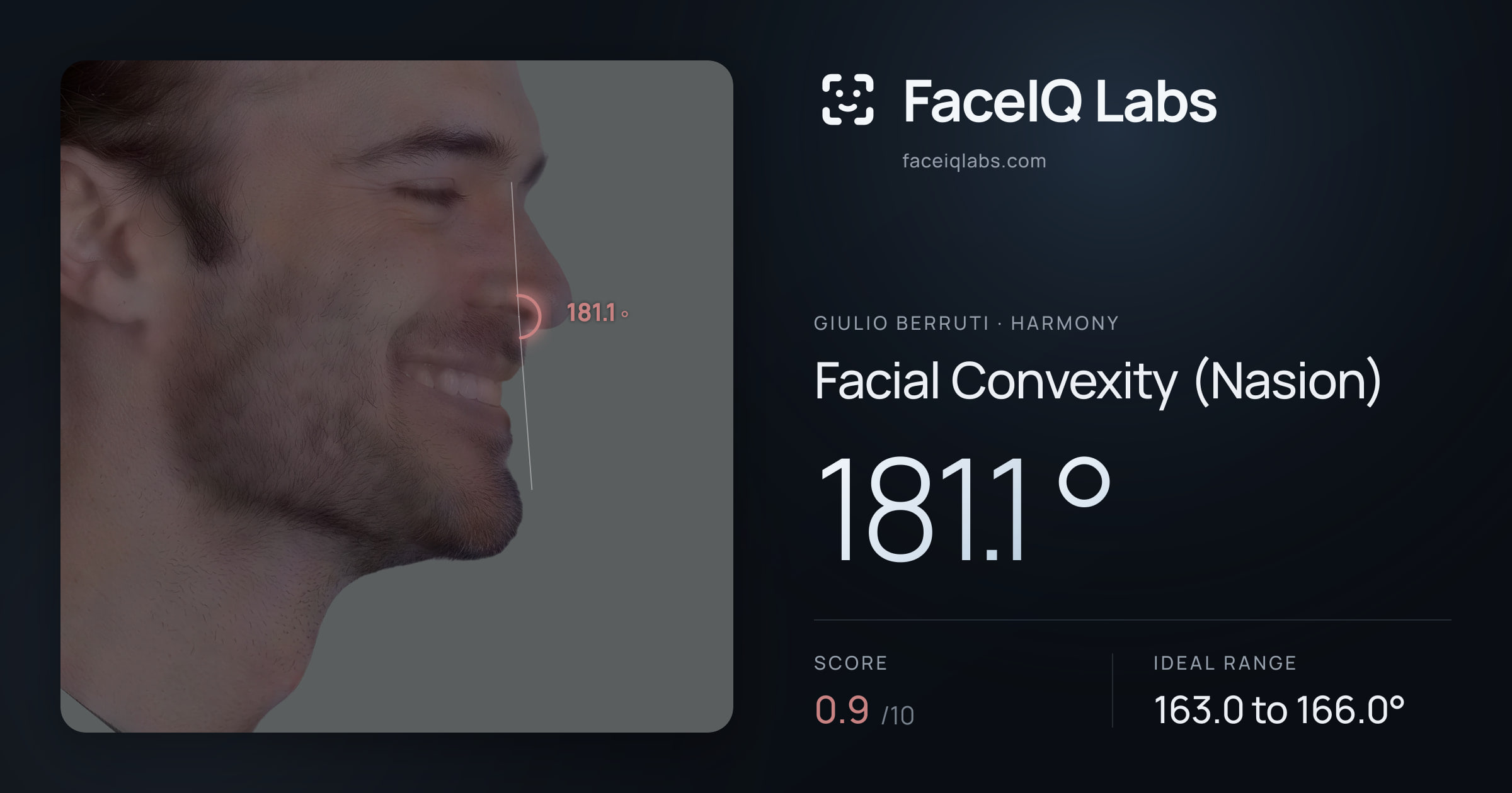 Giulio Berruti Facial Convexity (Nasion): 181.1°, drawn on the photo
