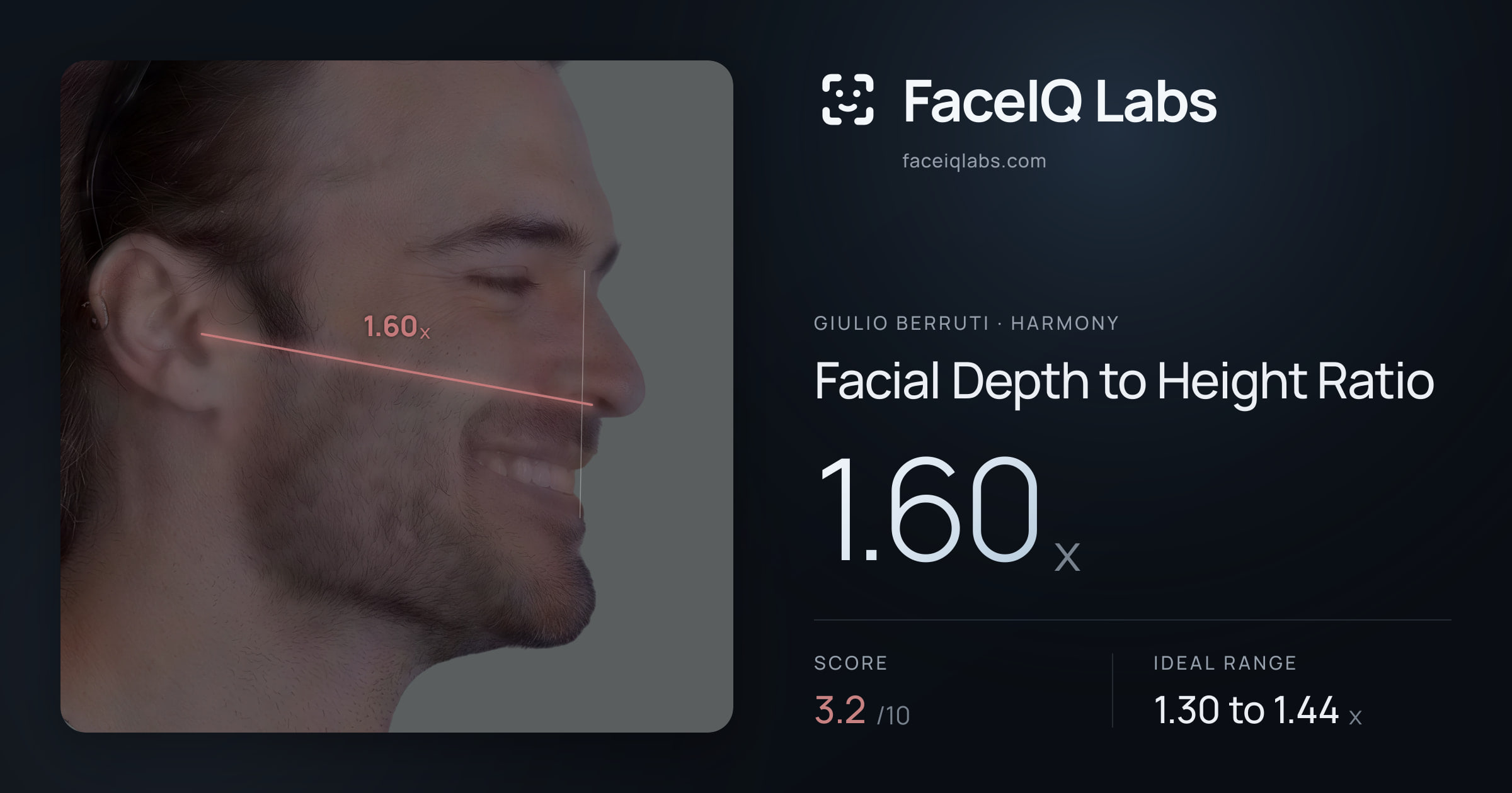 Giulio Berruti Facial Depth to Height Ratio: 1.60x, drawn on the photo