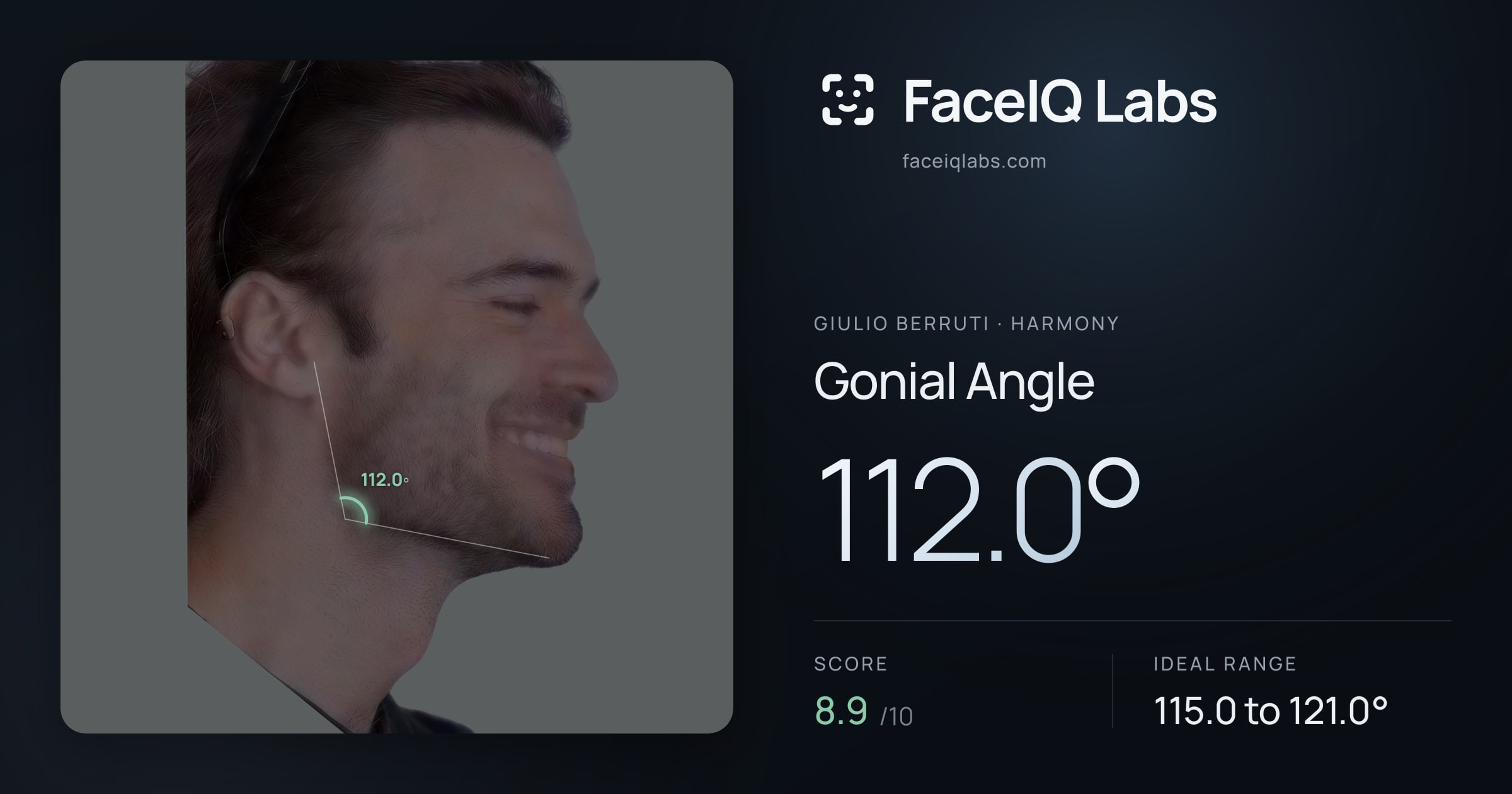 Giulio Berruti Gonial Angle: 112.0°, drawn on the photo