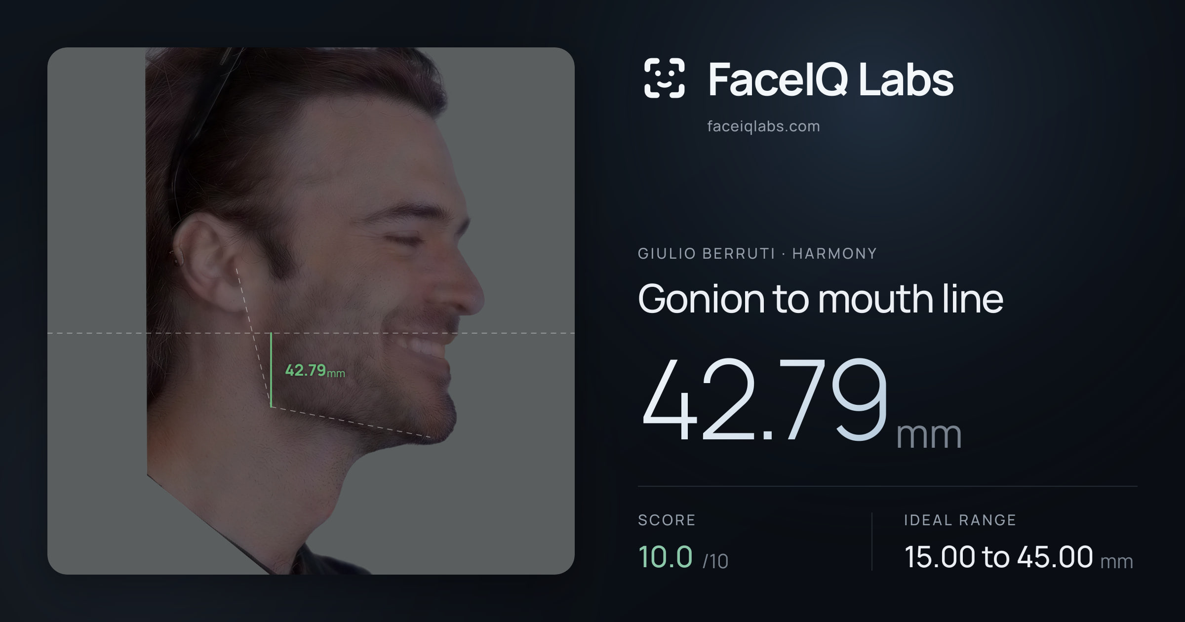 Giulio Berruti Gonion to mouth line: 42.79mm, drawn on the photo