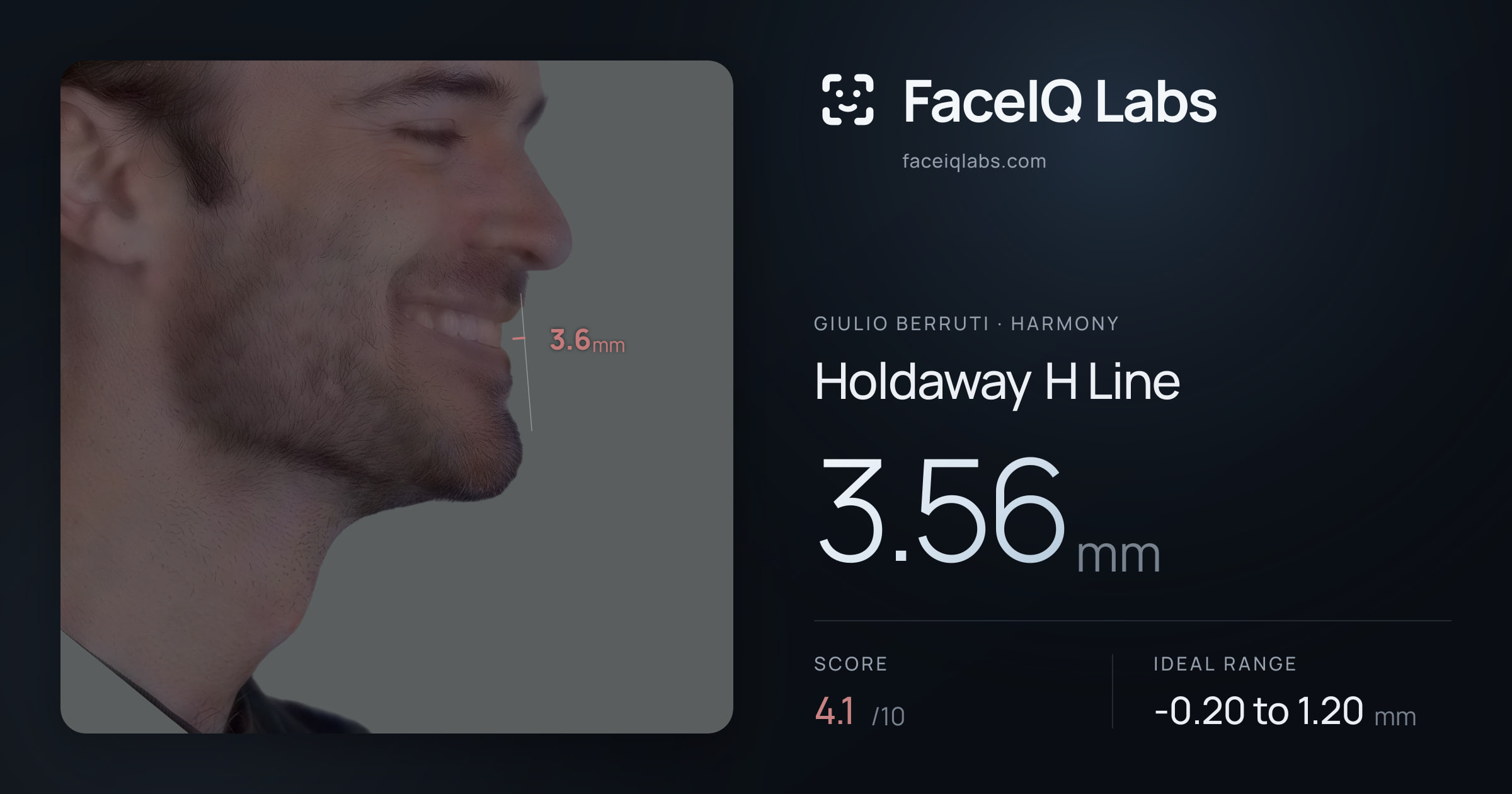 Giulio Berruti Holdaway H Line: 3.56mm, drawn on the photo